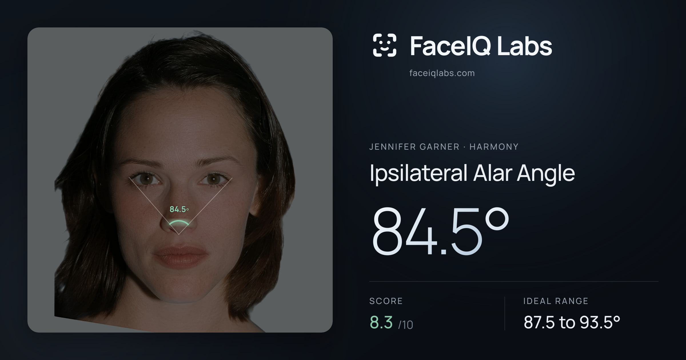 Jennifer Garner Ipsilateral Alar Angle: 84.5°, drawn on the photo