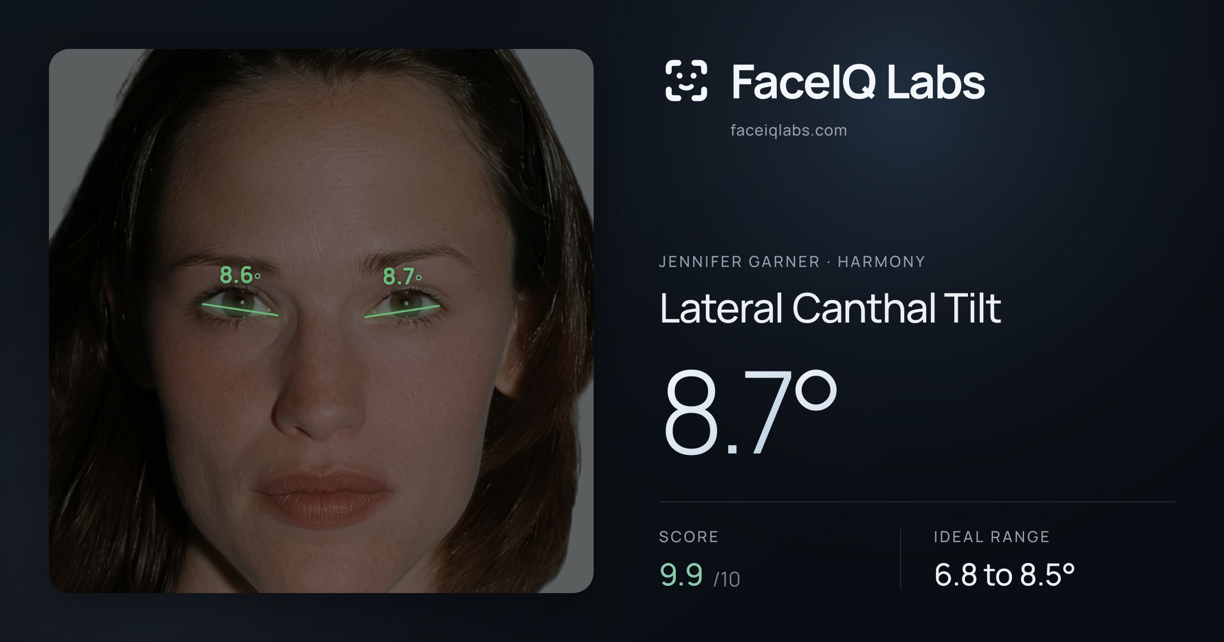 Jennifer Garner Lateral Canthal Tilt: 8.7°, drawn on the photo