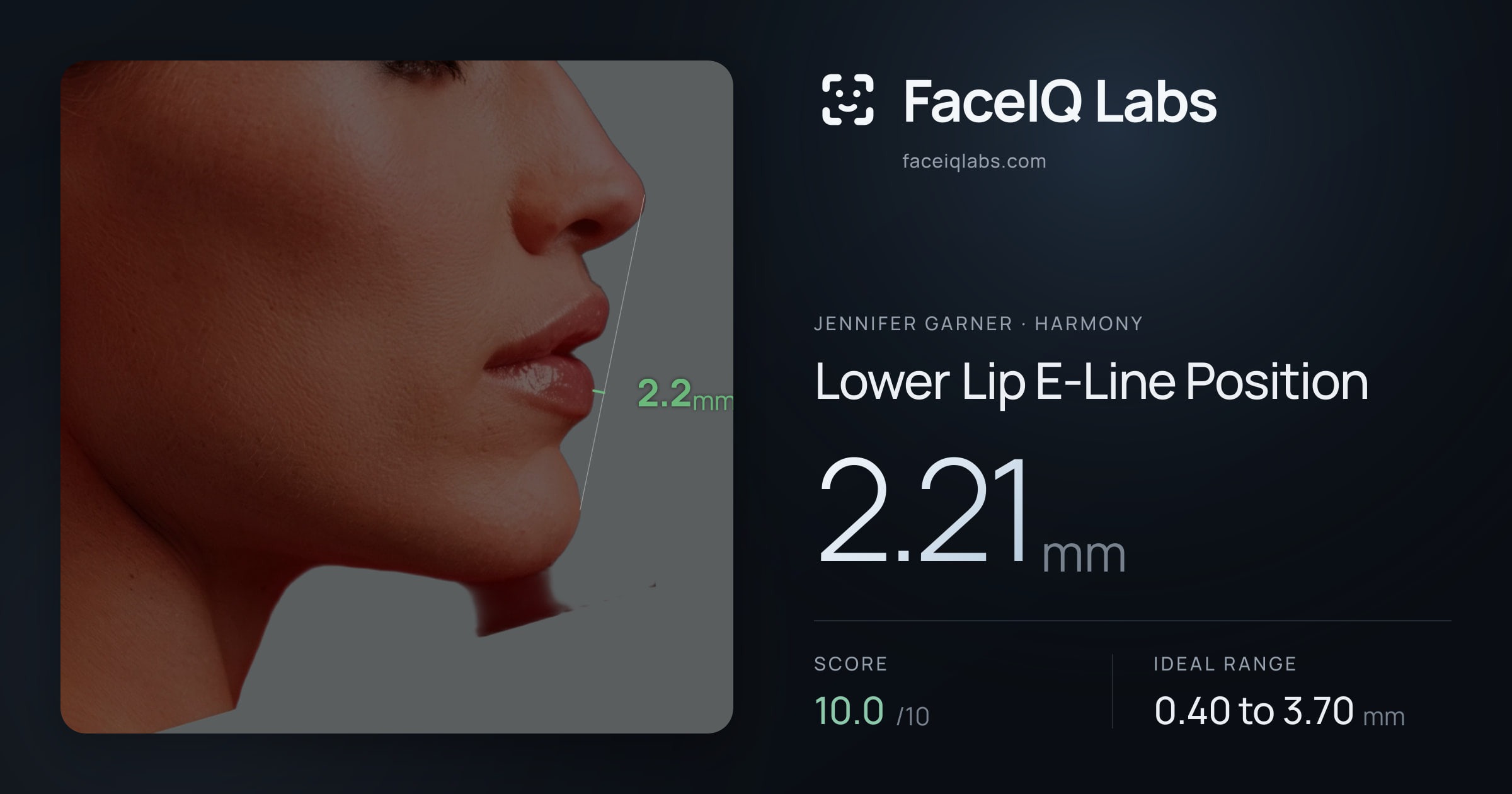 Jennifer Garner Lower Lip E-Line Position: 2.21mm, drawn on the photo