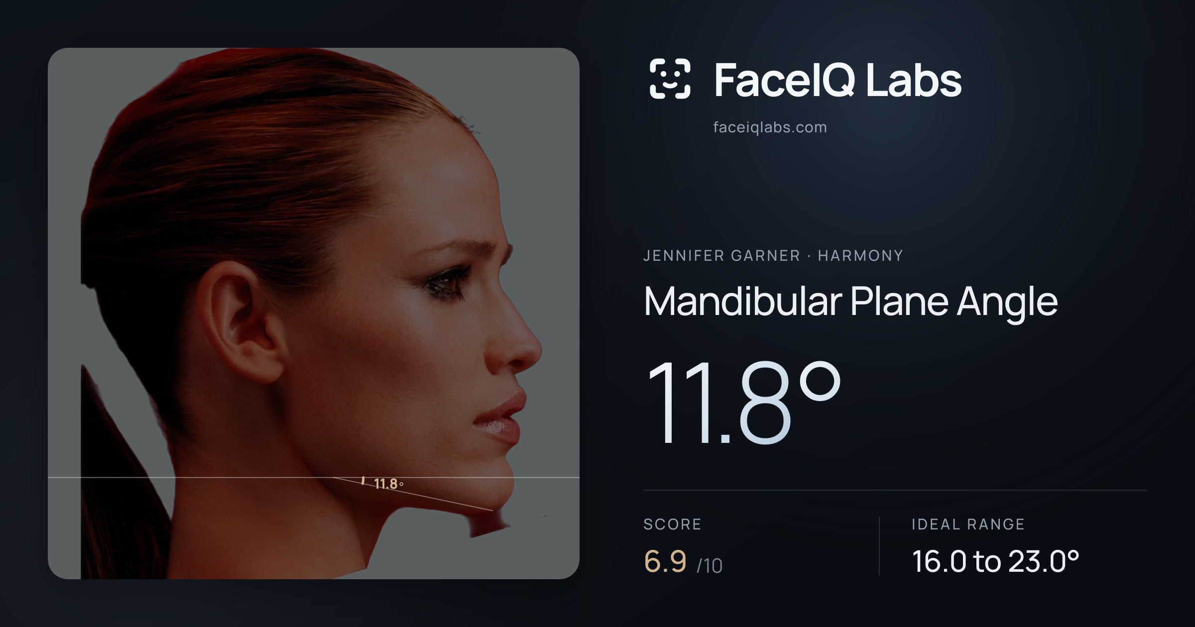 Jennifer Garner Mandibular Plane Angle: 11.8°, drawn on the photo