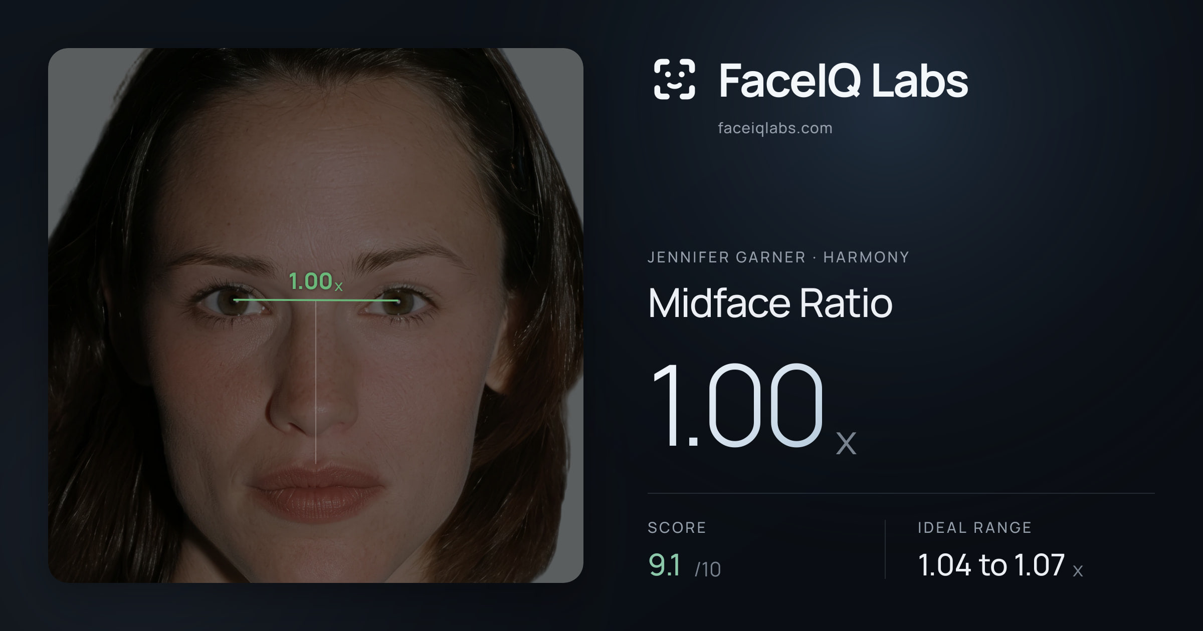 Jennifer Garner Midface Ratio: 1.00x, drawn on the photo