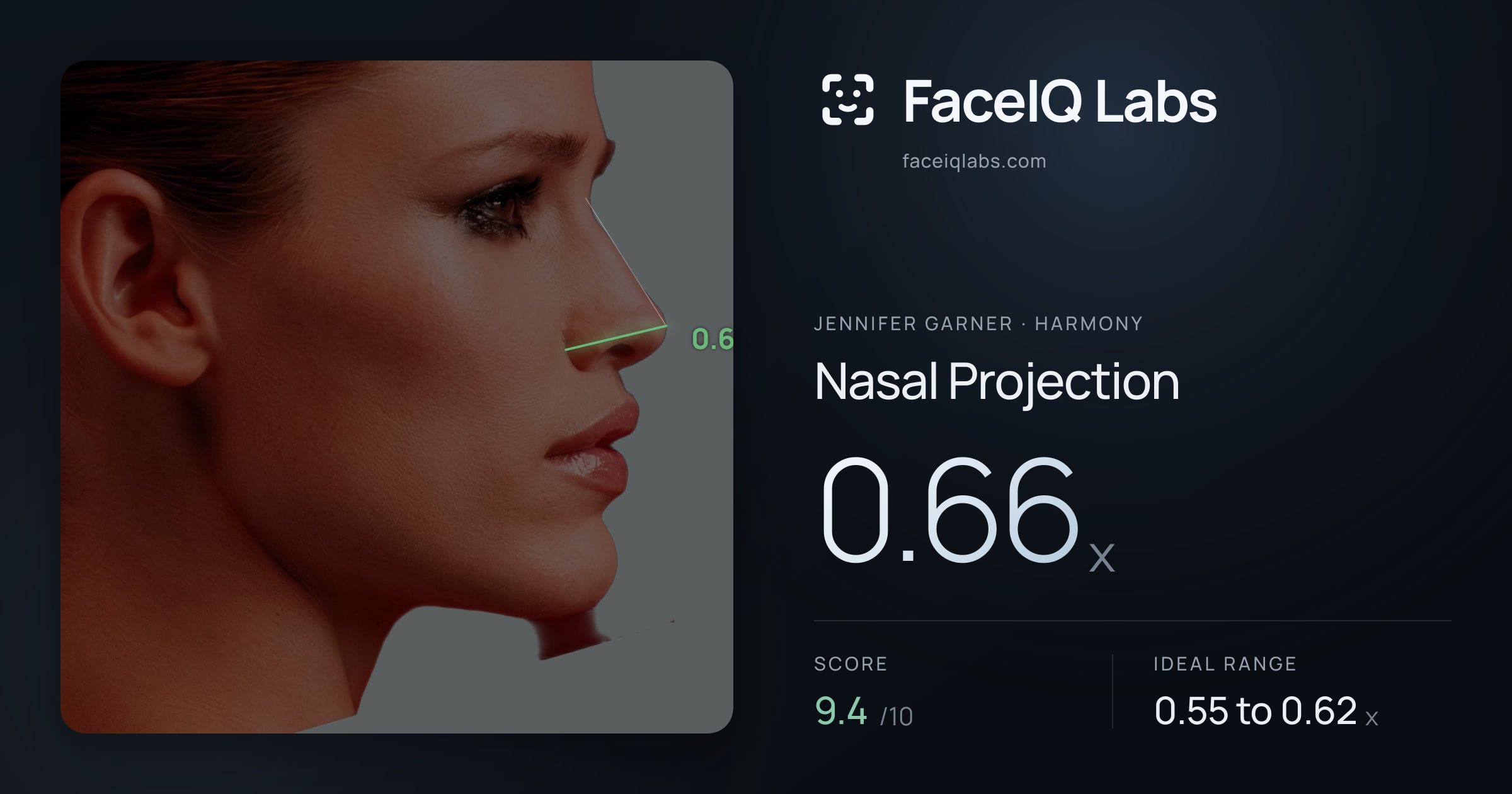 Jennifer Garner Nasal Projection: 0.66x, drawn on the photo