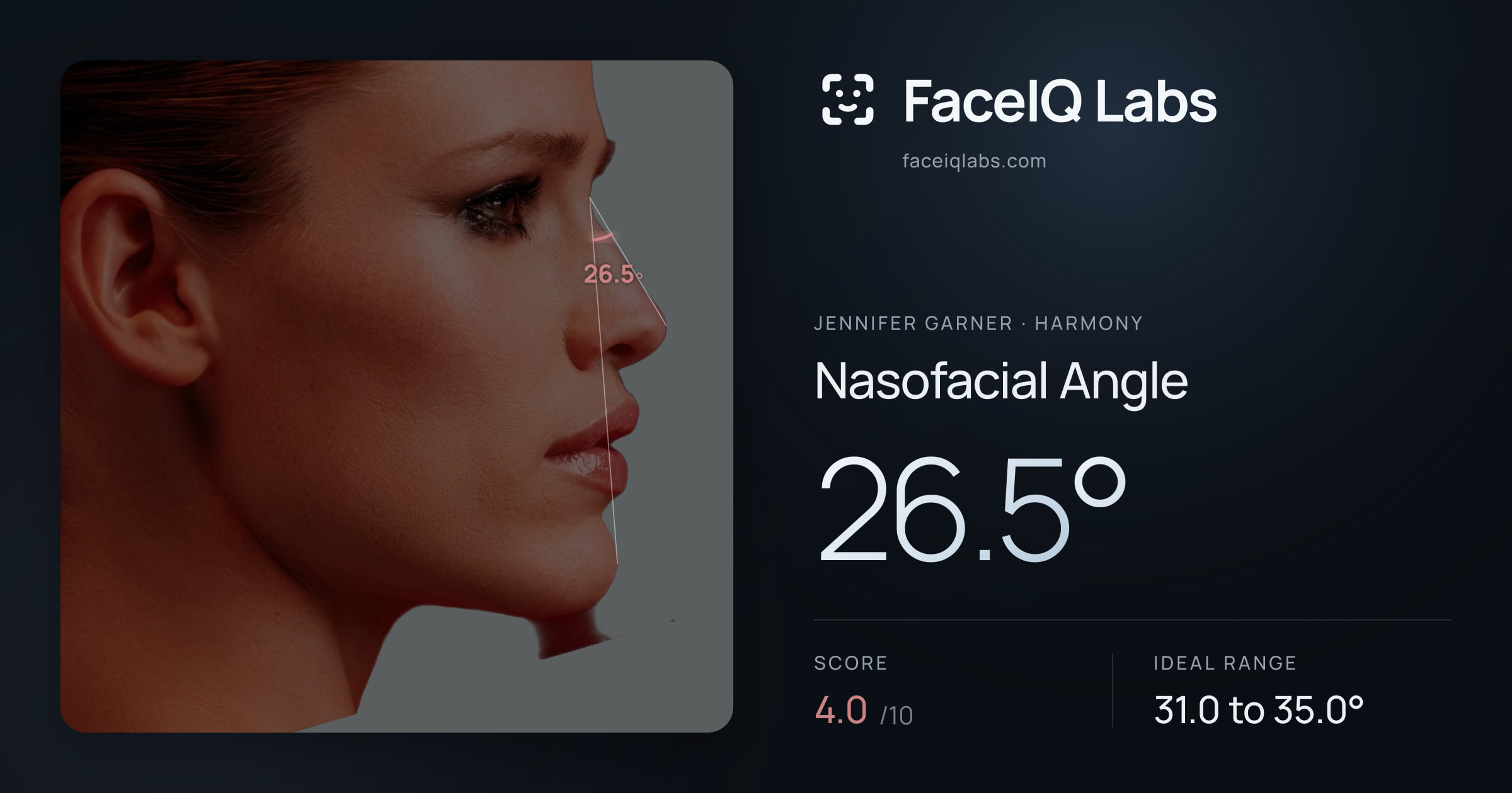 Jennifer Garner Nasofacial Angle: 26.5°, drawn on the photo