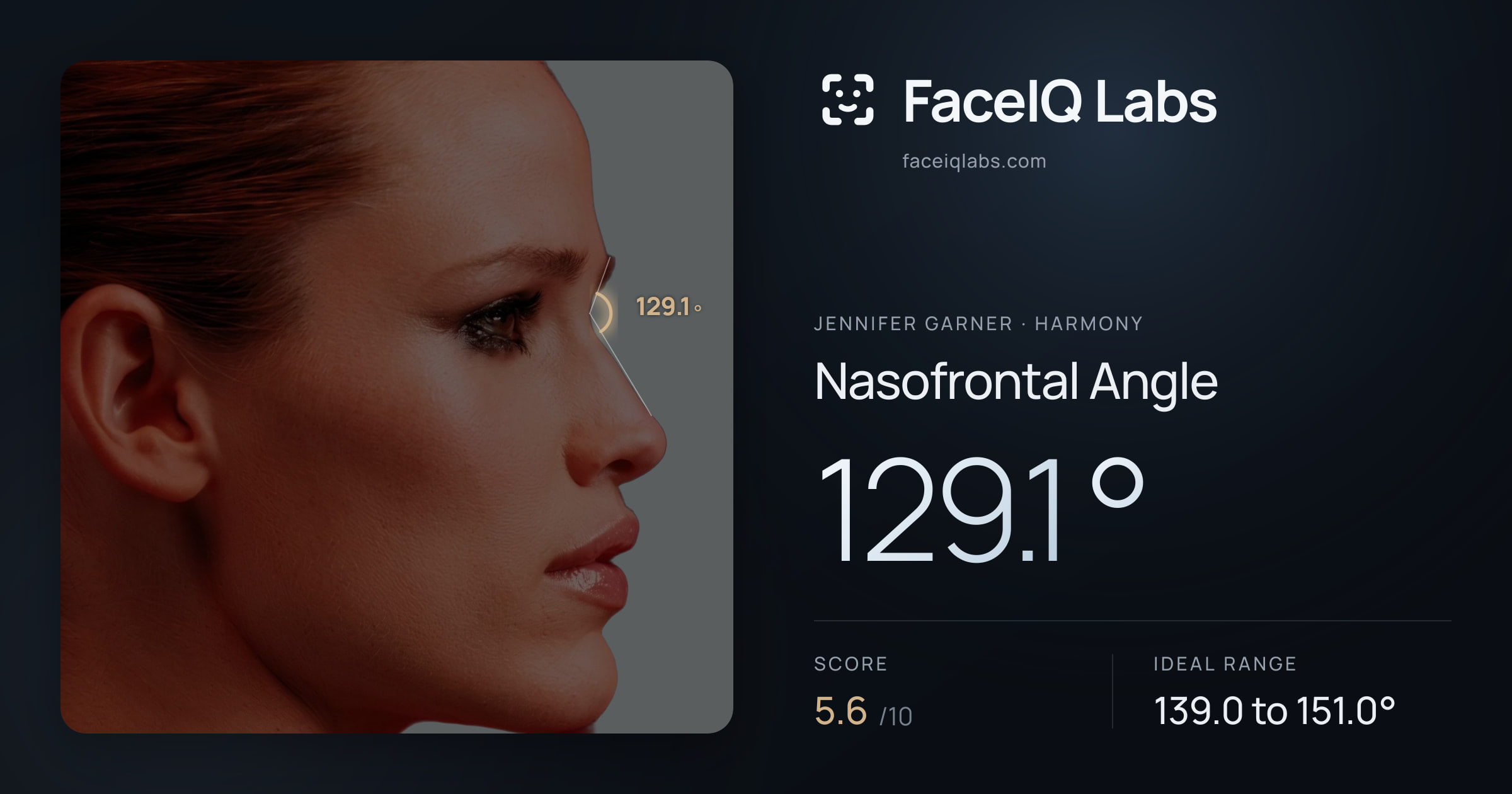 Jennifer Garner Nasofrontal Angle: 129.1°, drawn on the photo