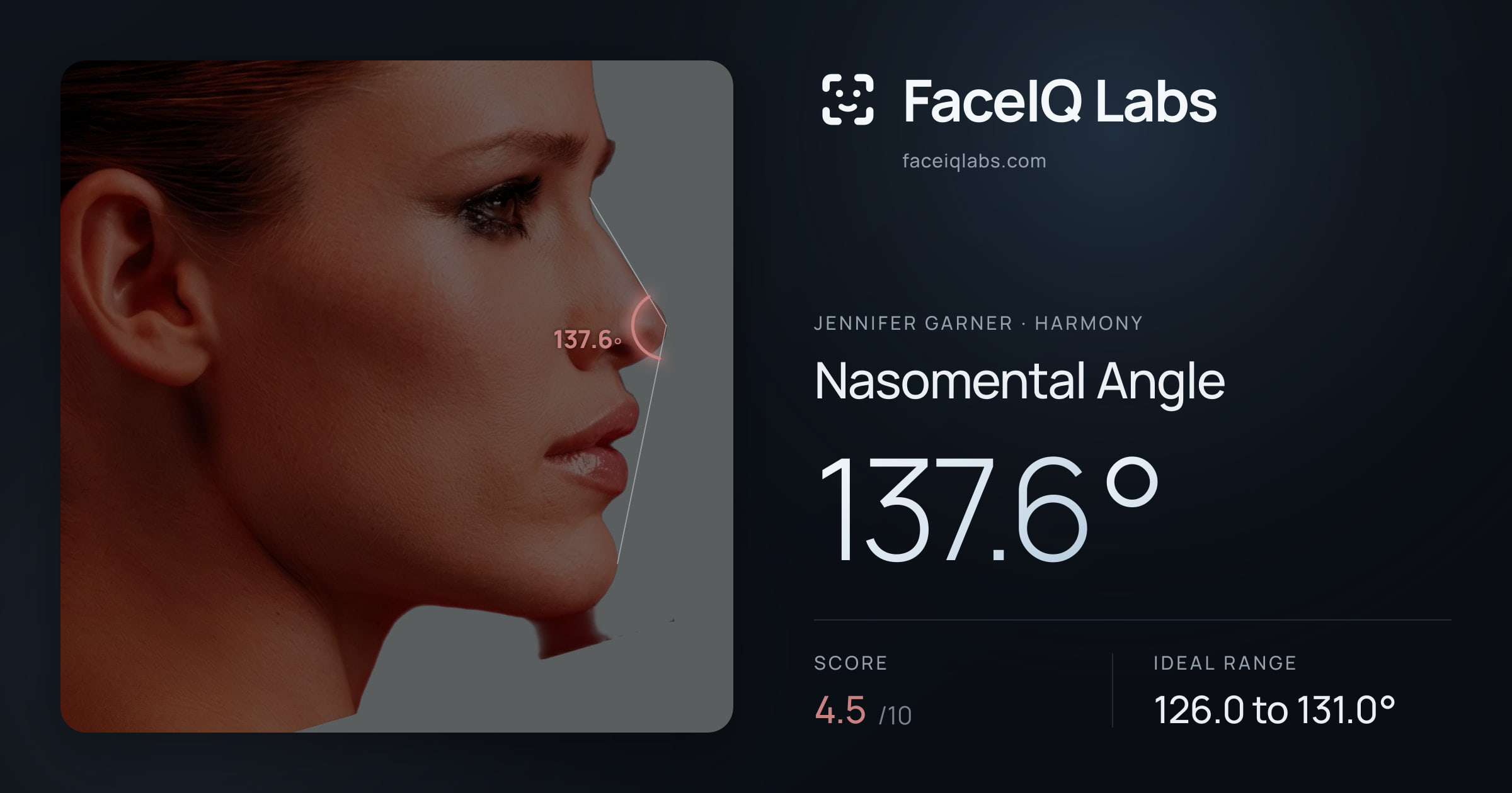 Jennifer Garner Nasomental Angle: 137.6°, drawn on the photo