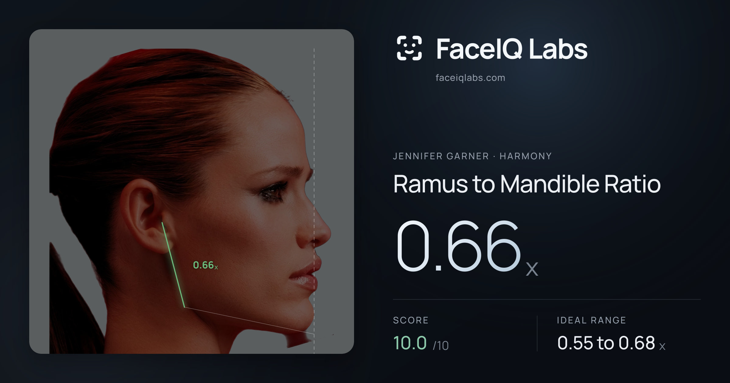 Jennifer Garner Ramus to Mandible Ratio: 0.66x, drawn on the photo
