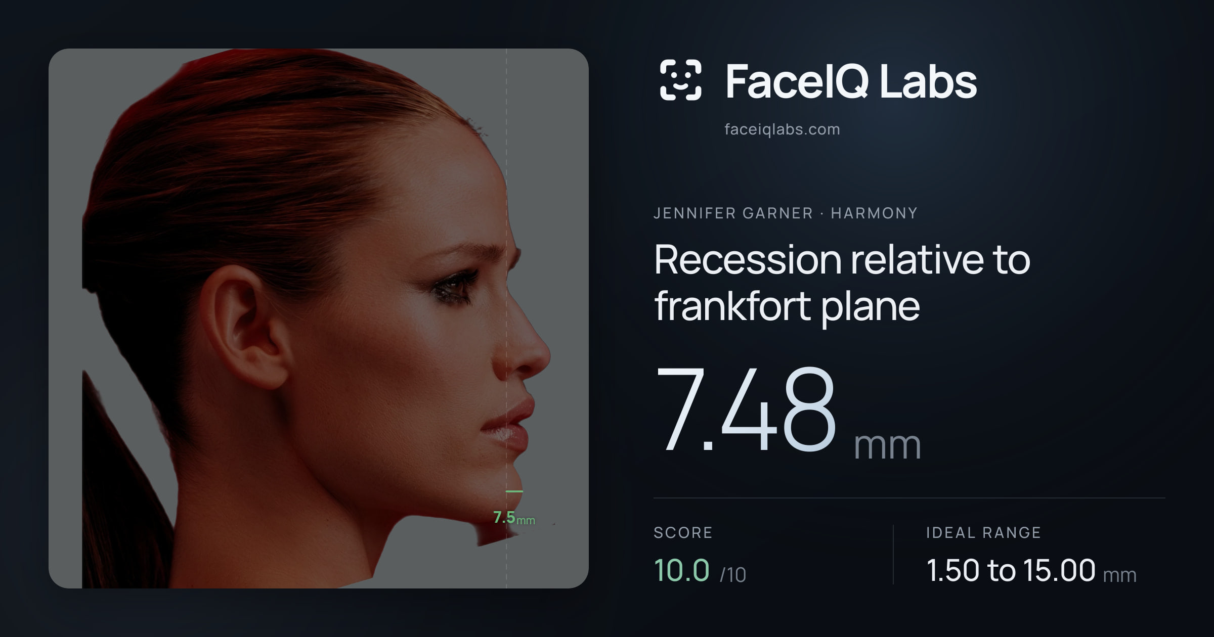 Jennifer Garner Recession relative to frankfort plane: 7.48mm, drawn on the photo