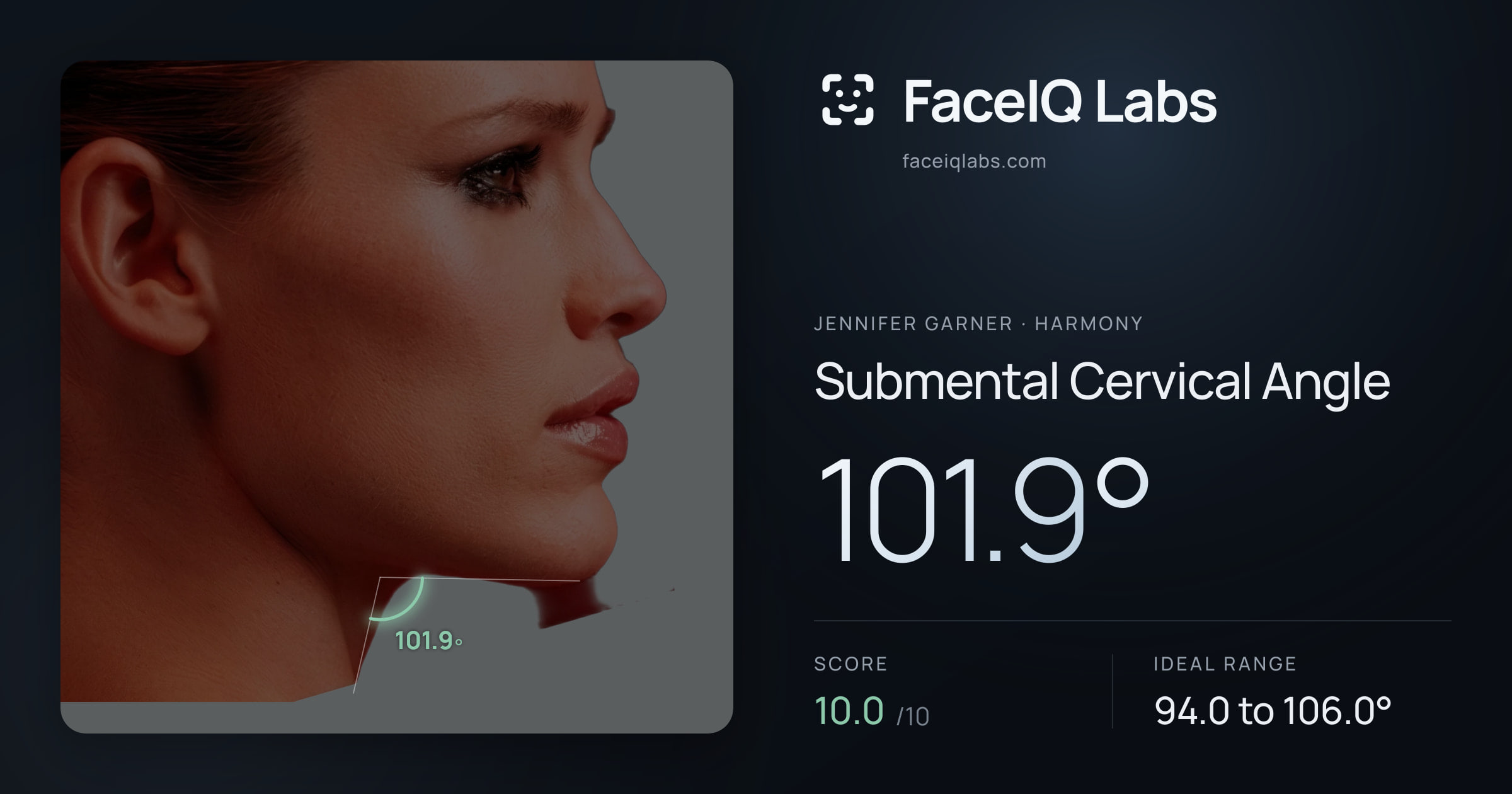 Jennifer Garner Submental Cervical Angle: 101.9°, drawn on the photo