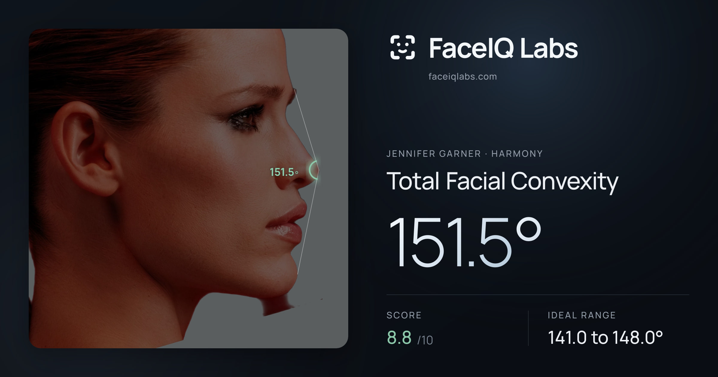 Jennifer Garner Total Facial Convexity: 151.5°, drawn on the photo
