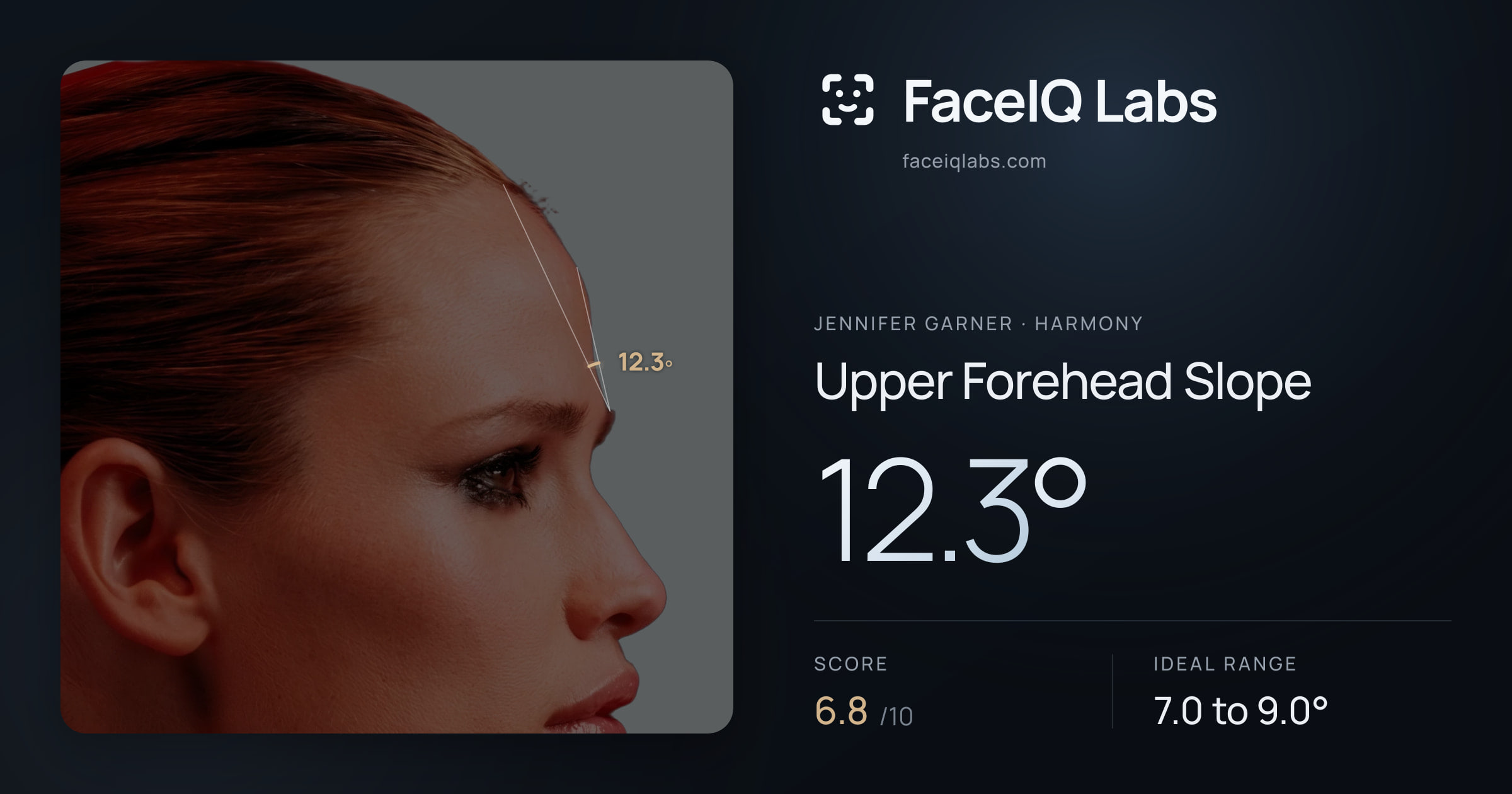 Jennifer Garner Upper Forehead Slope: 12.3°, drawn on the photo