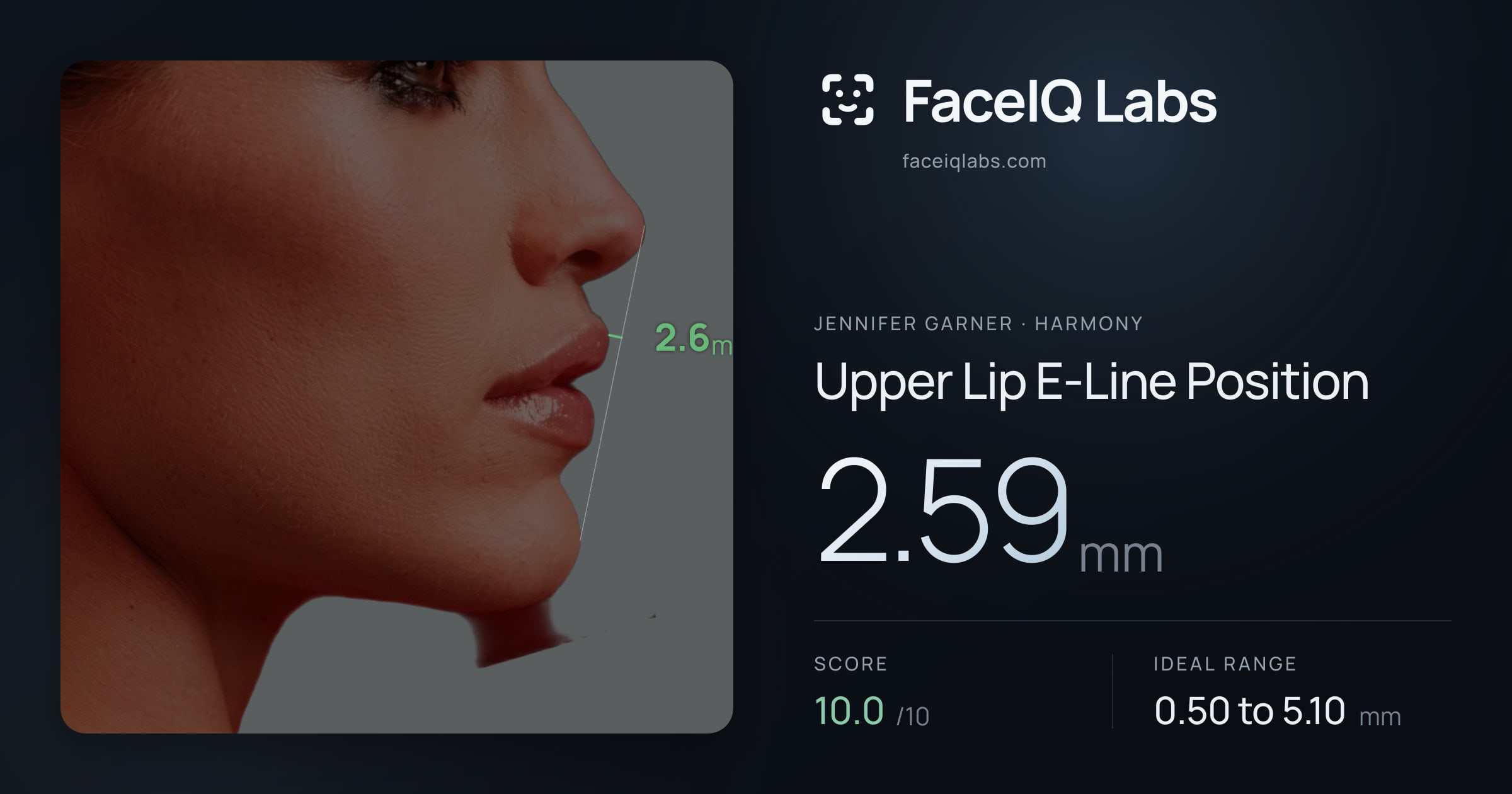 Jennifer Garner Upper Lip E-Line Position: 2.59mm, drawn on the photo