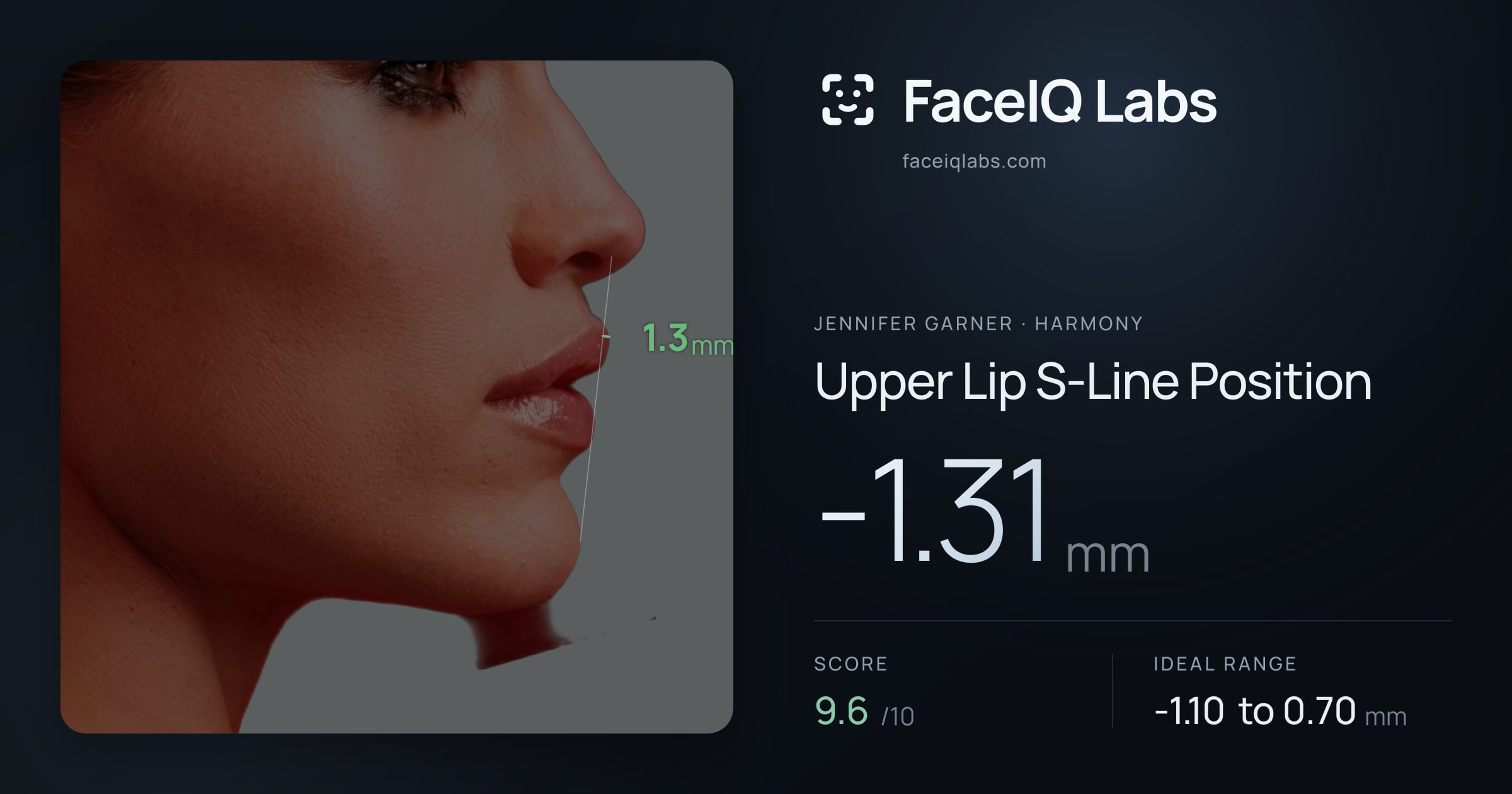 Jennifer Garner Upper Lip S-Line Position: -1.31mm, drawn on the photo
