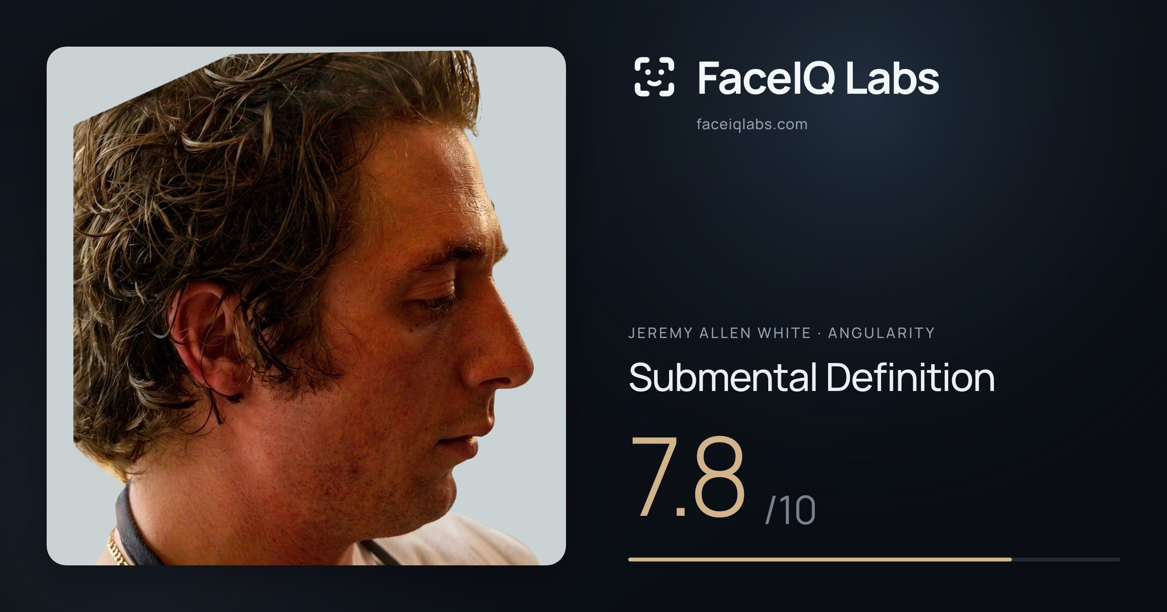 Jeremy Allen White Submental Definition: 7.8/10, drawn on the photo