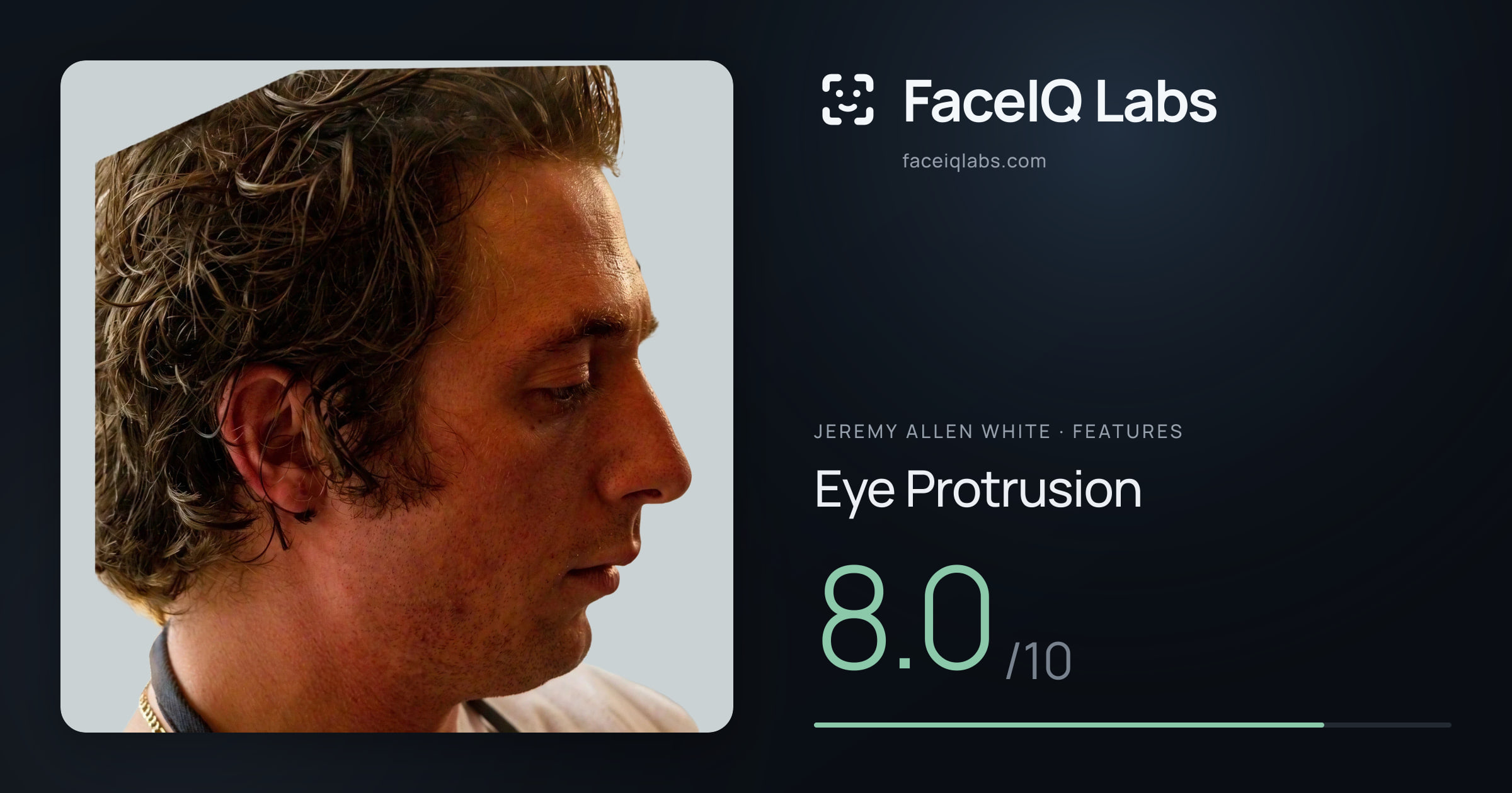 Jeremy Allen White Eye Protrusion: 8.0/10, drawn on the photo