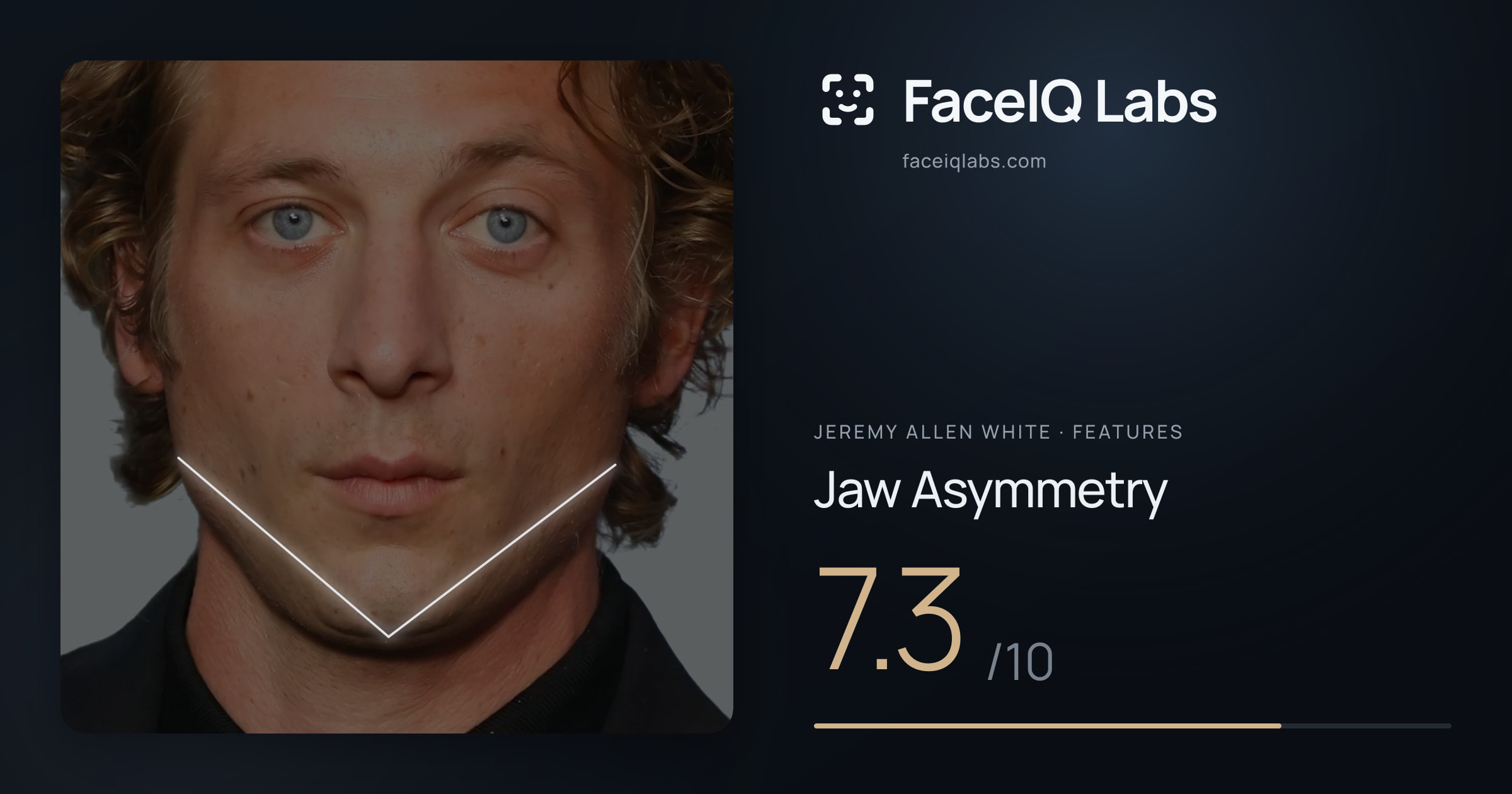 Jeremy Allen White Jaw Asymmetry: 7.3/10, drawn on the photo