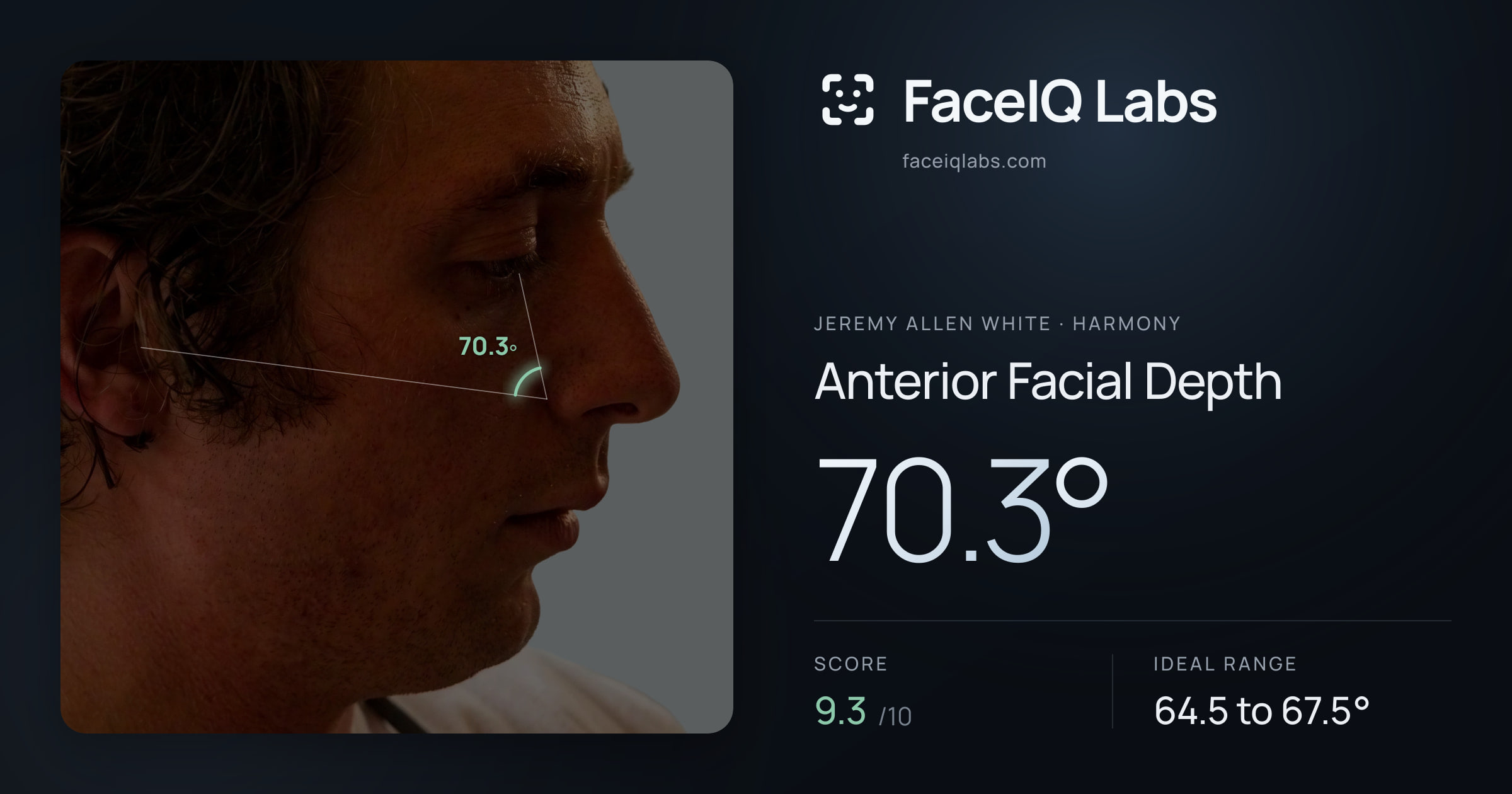Jeremy Allen White Anterior Facial Depth: 70.3°, drawn on the photo