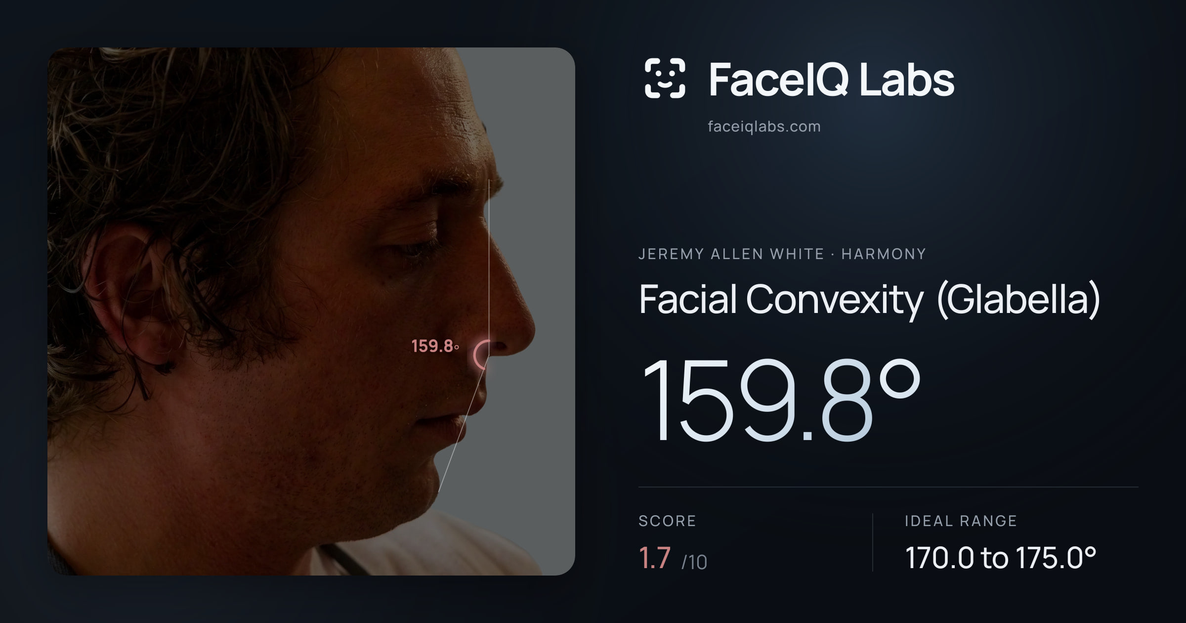 Jeremy Allen White Facial Convexity (Glabella): 159.8°, drawn on the photo
