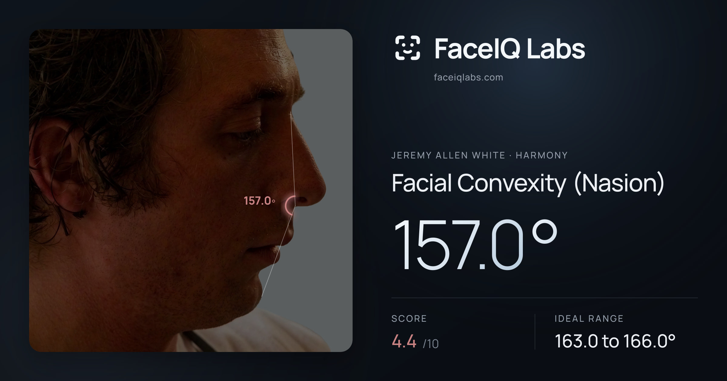 Jeremy Allen White Facial Convexity (Nasion): 157.0°, drawn on the photo
