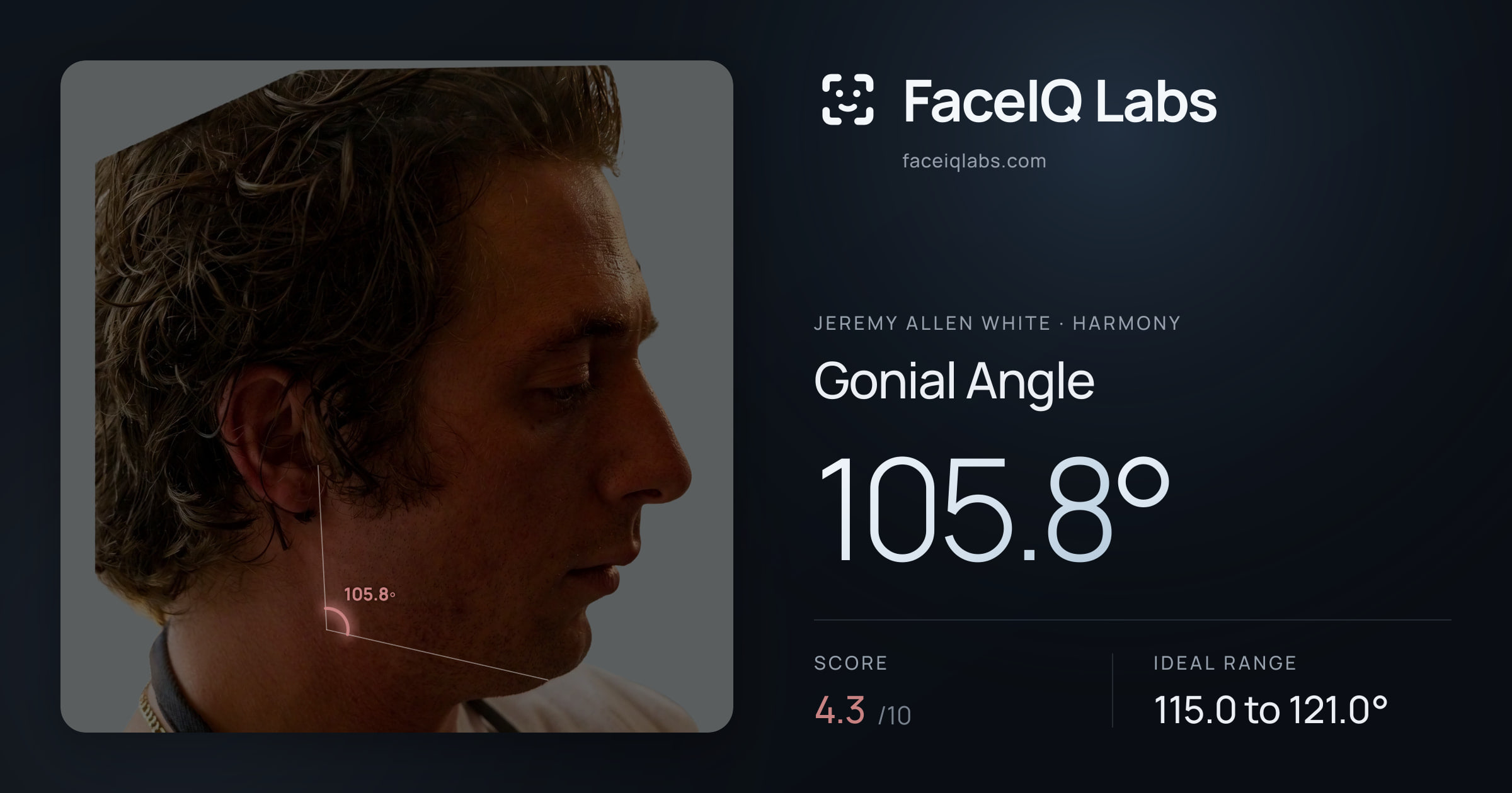 Jeremy Allen White Gonial Angle: 105.8°, drawn on the photo
