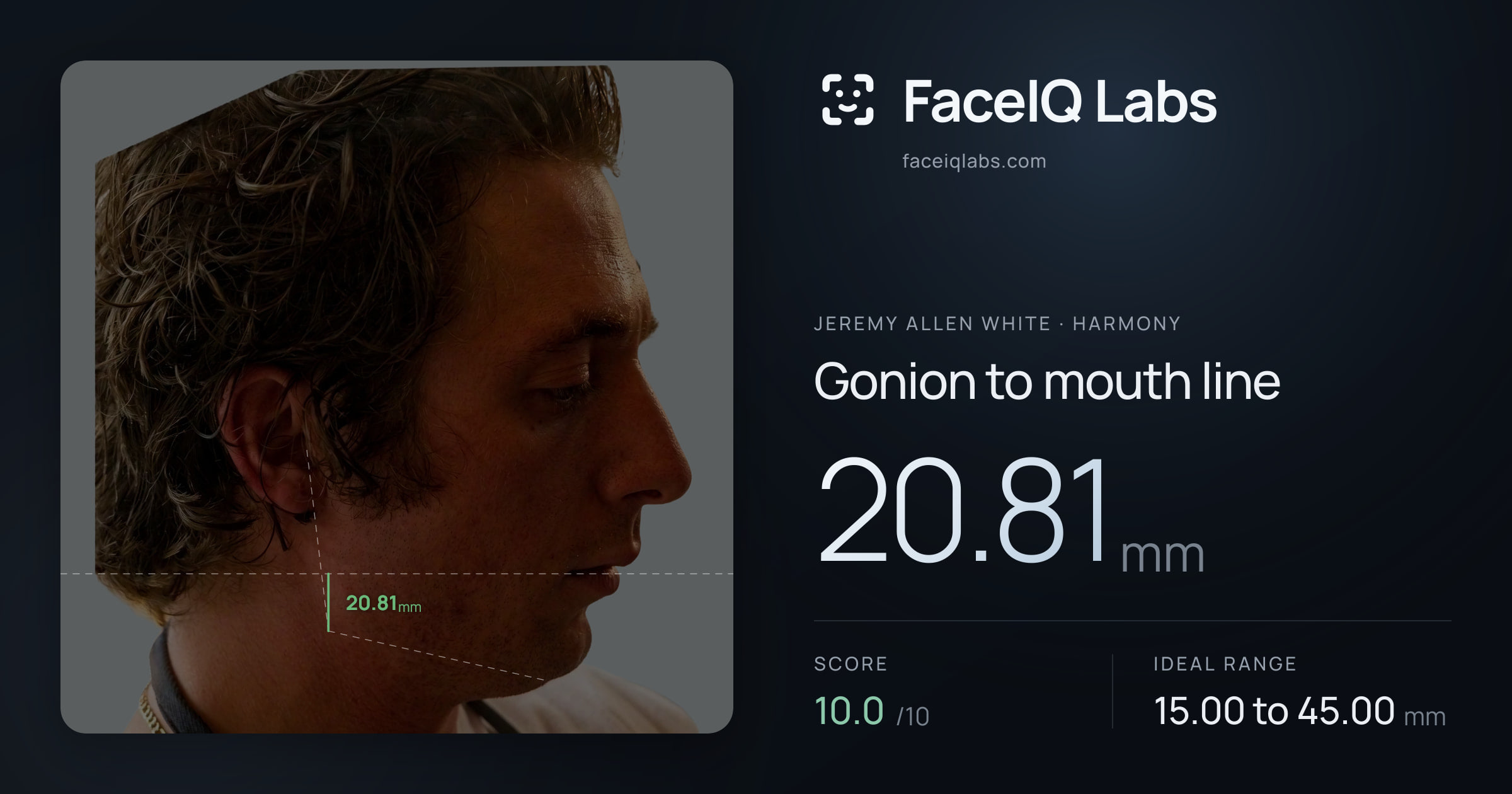 Jeremy Allen White Gonion to mouth line: 20.81mm, drawn on the photo