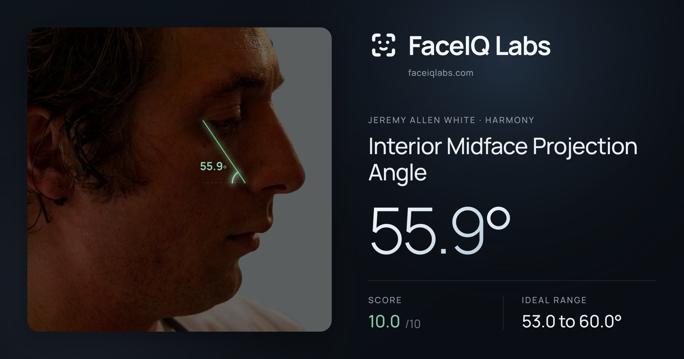 Jeremy Allen White Interior Midface Projection Angle: 55.9°, drawn on the photo