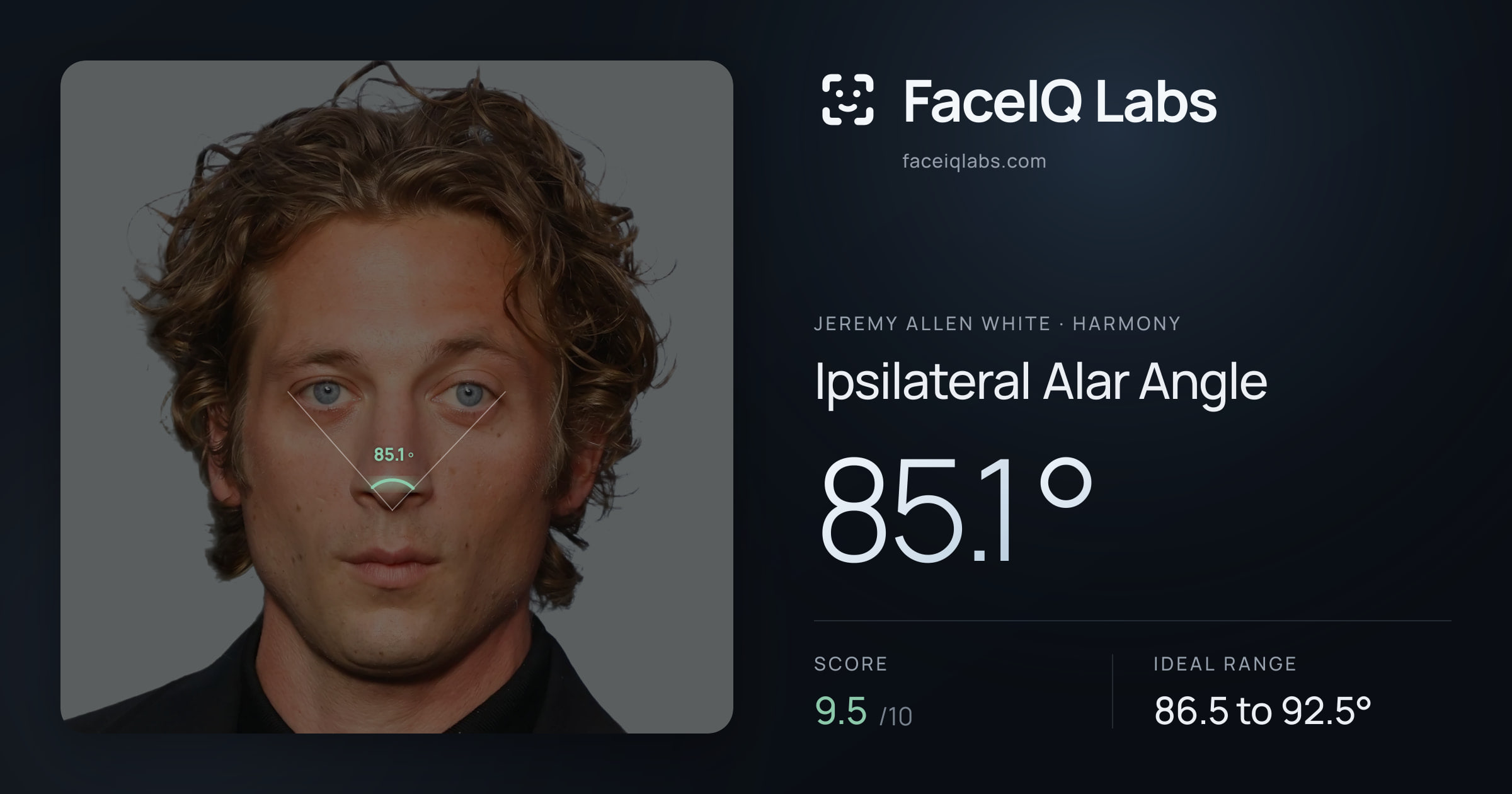 Jeremy Allen White Ipsilateral Alar Angle: 85.1°, drawn on the photo