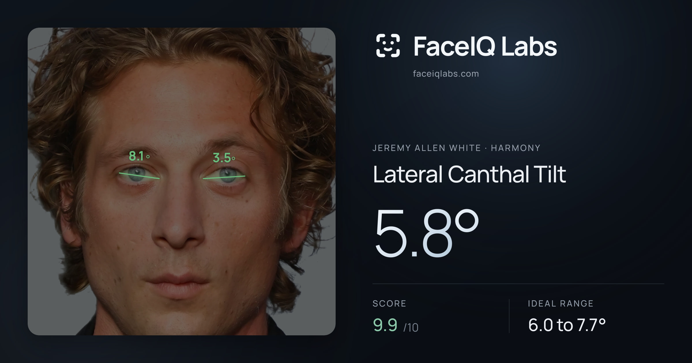 Jeremy Allen White Lateral Canthal Tilt: 5.8°, drawn on the photo
