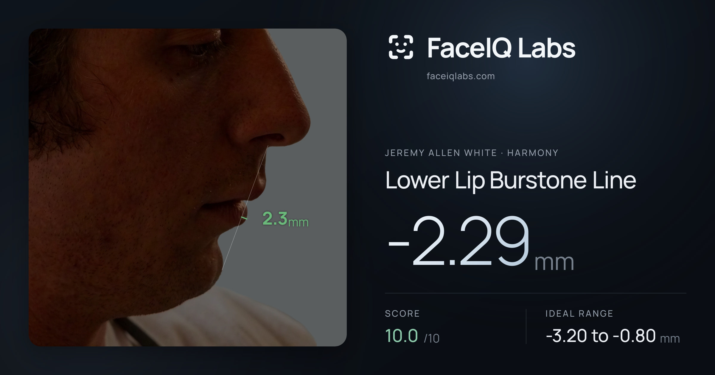 Jeremy Allen White Lower Lip Burstone Line: -2.29mm, drawn on the photo