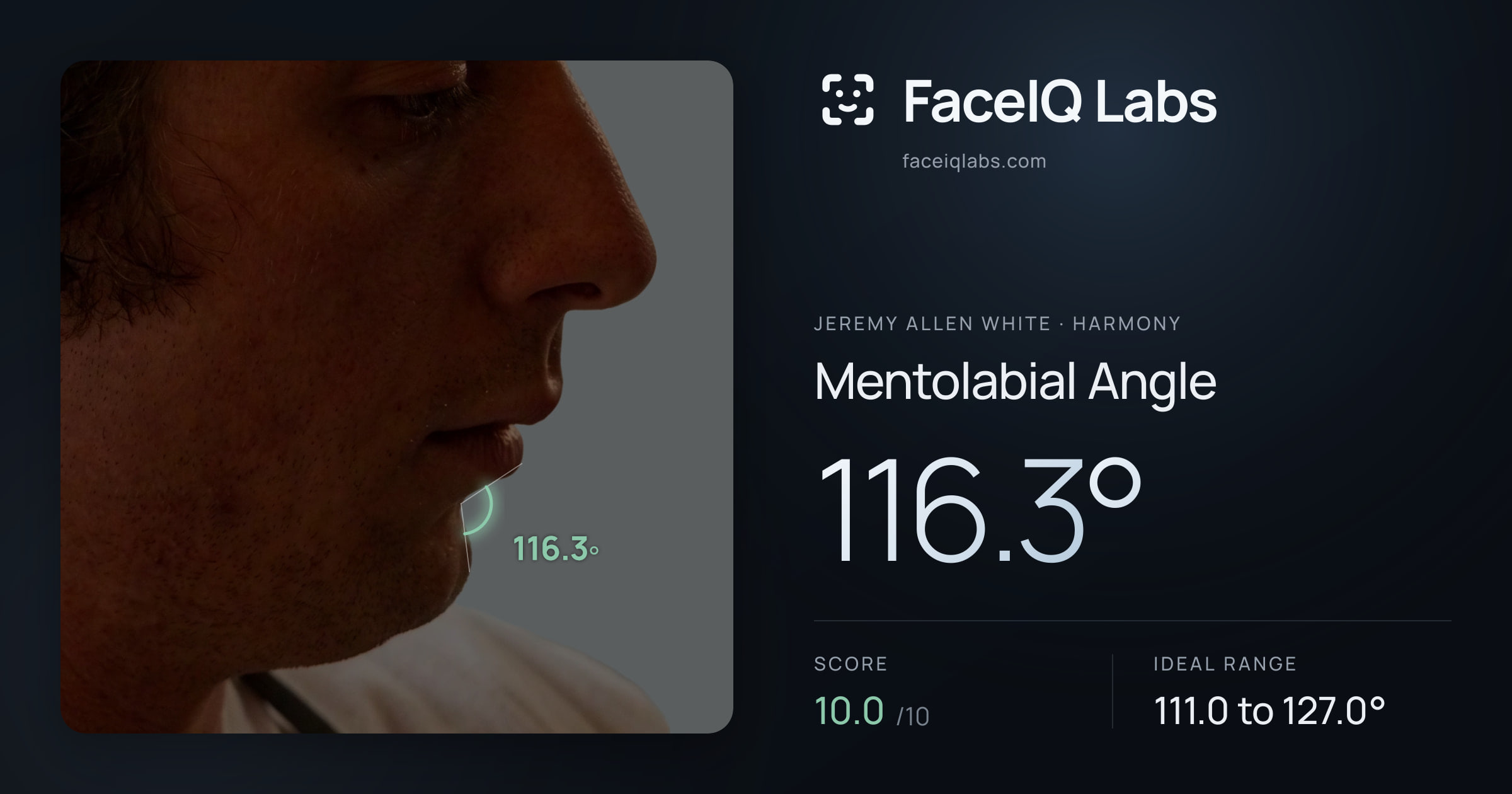 Jeremy Allen White Mentolabial Angle: 116.3°, drawn on the photo