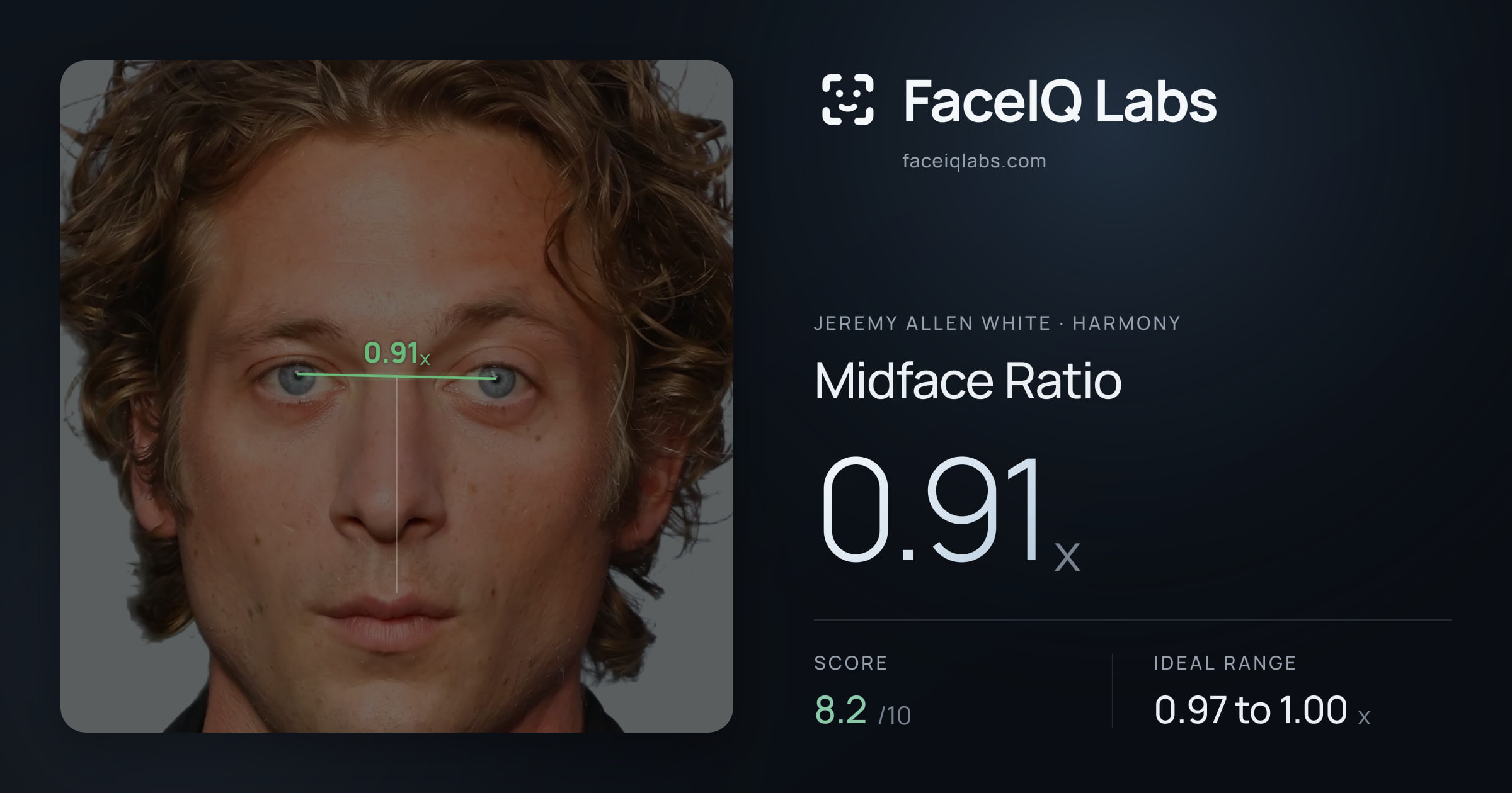 Jeremy Allen White Midface Ratio: 0.91x, drawn on the photo