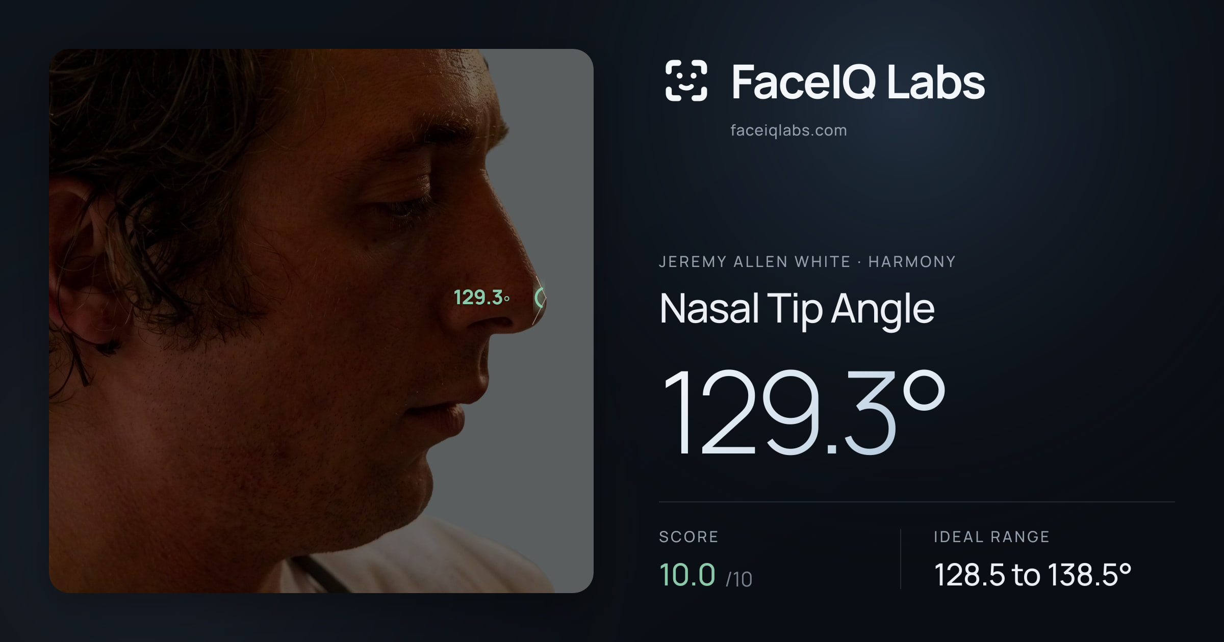 Jeremy Allen White Nasal Tip Angle: 129.3°, drawn on the photo