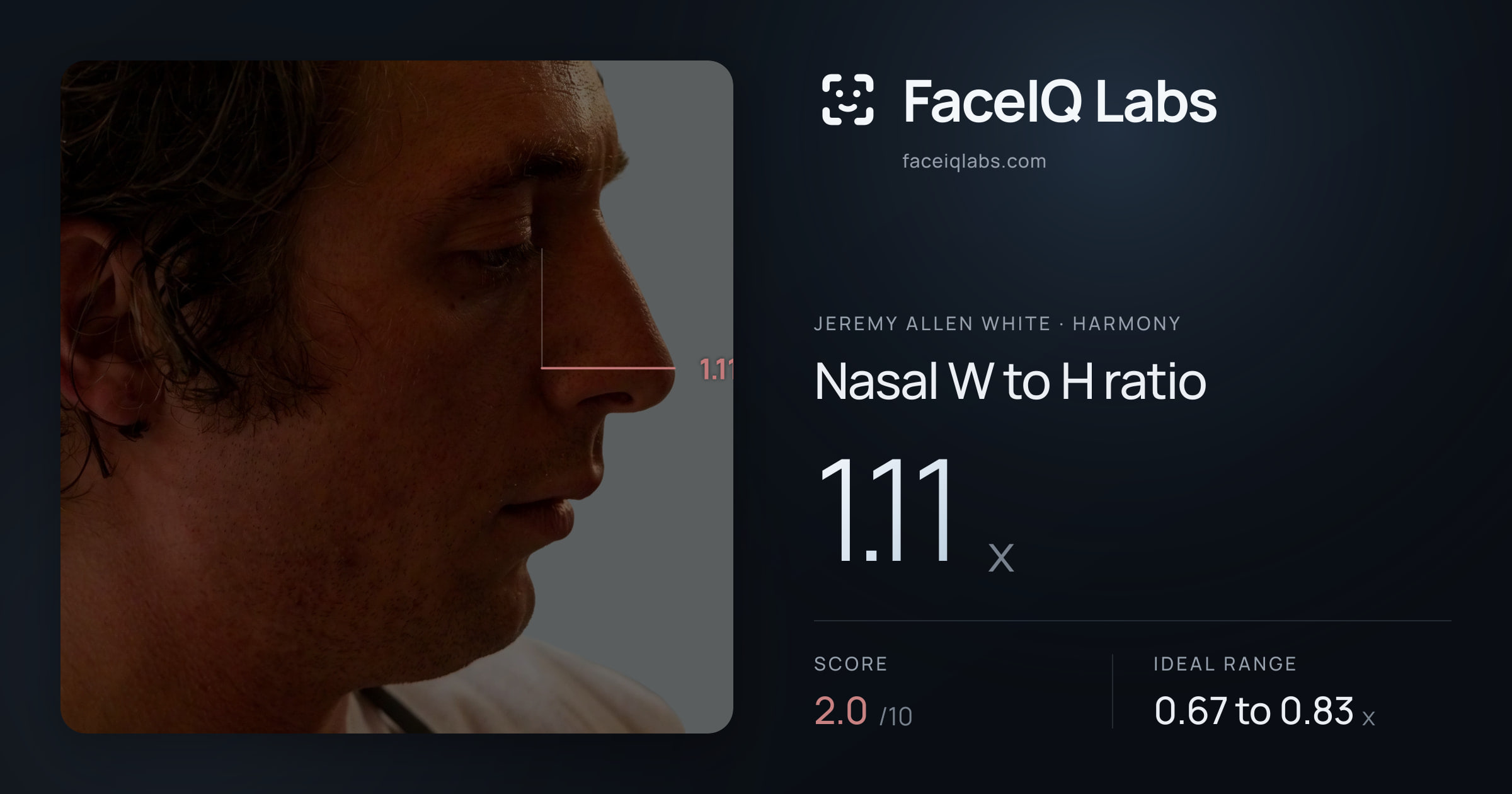 Jeremy Allen White Nasal W to H ratio: 1.11x, drawn on the photo