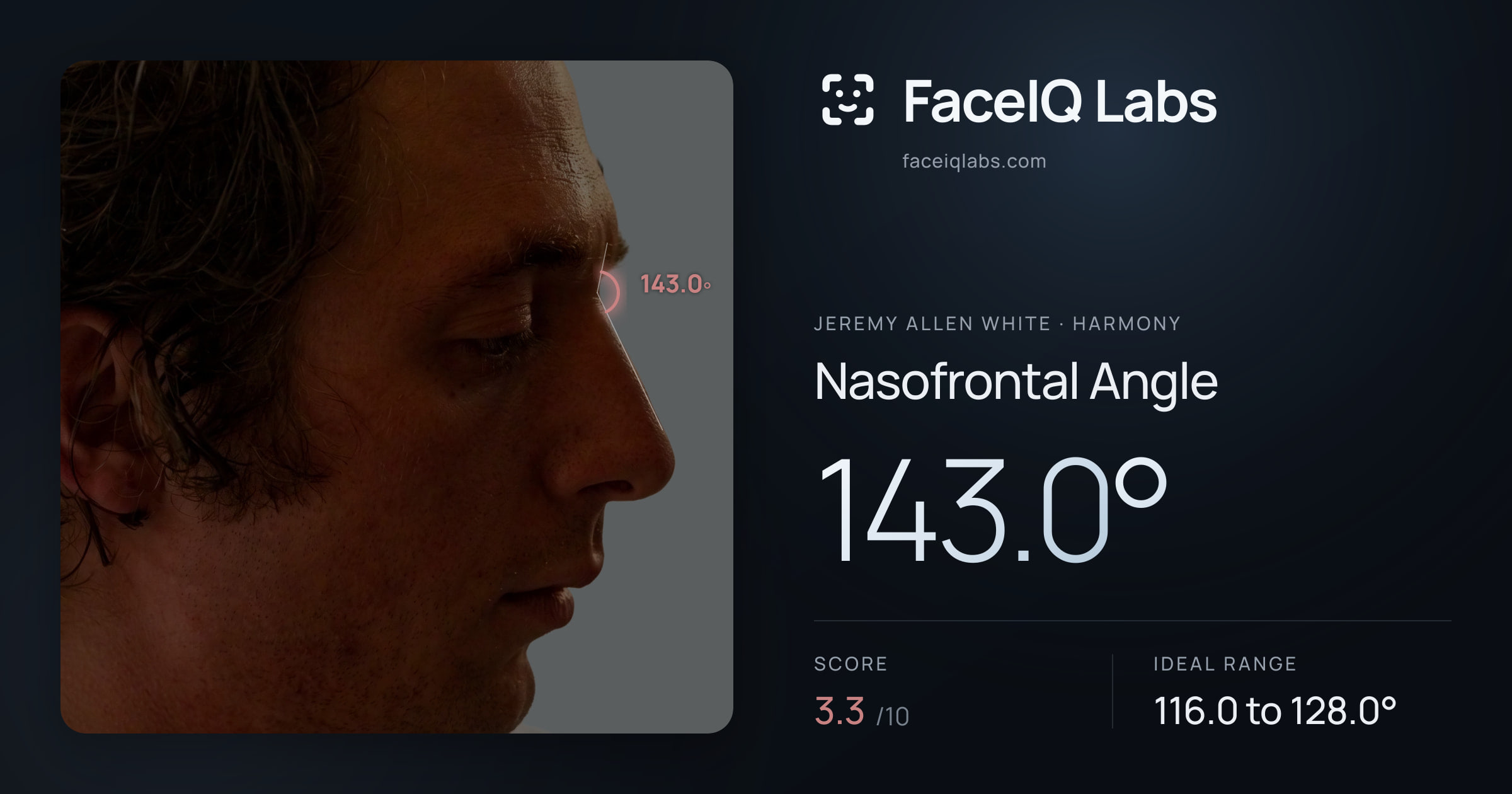 Jeremy Allen White Nasofrontal Angle: 143.0°, drawn on the photo