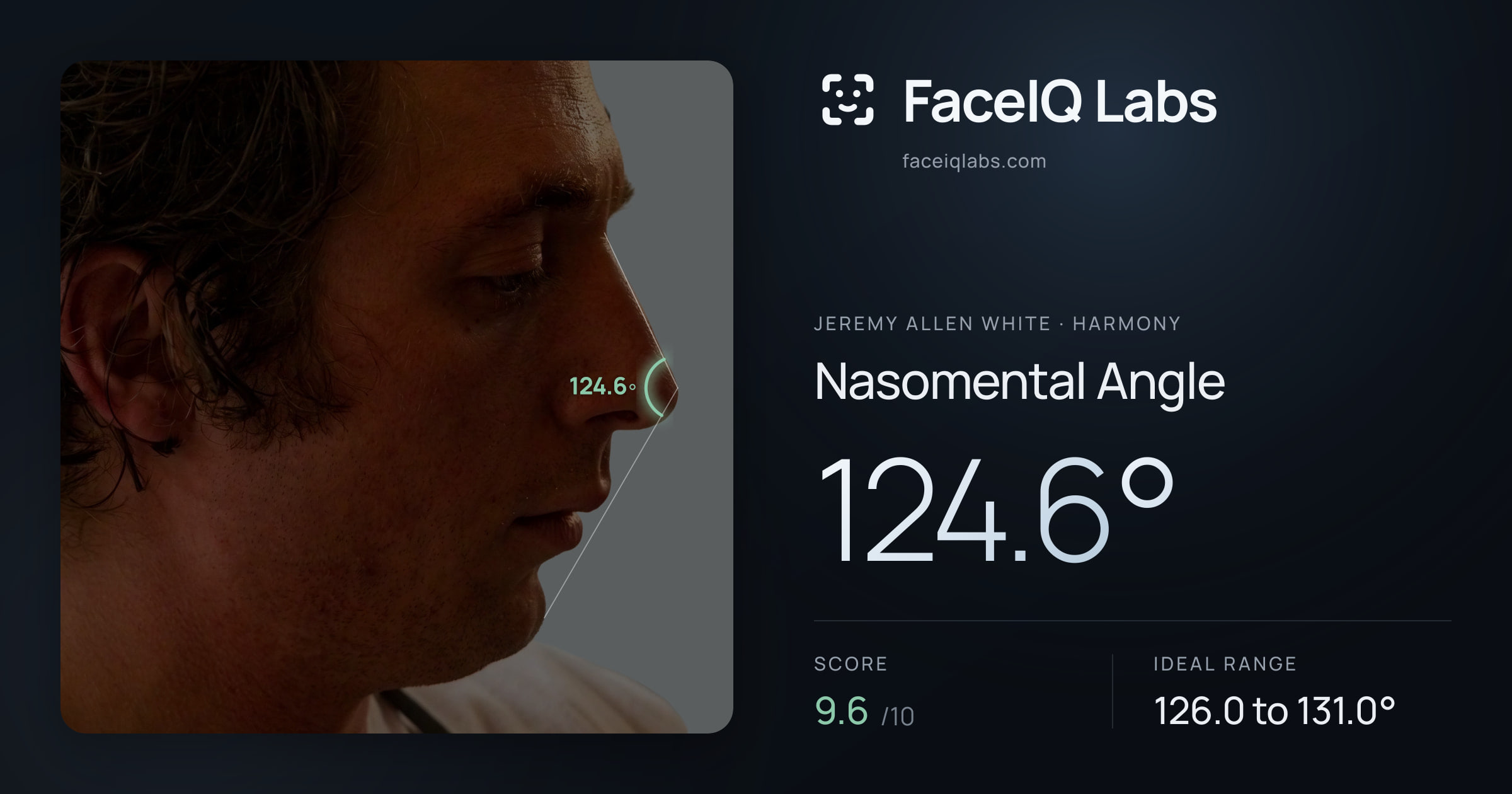 Jeremy Allen White Nasomental Angle: 124.6°, drawn on the photo