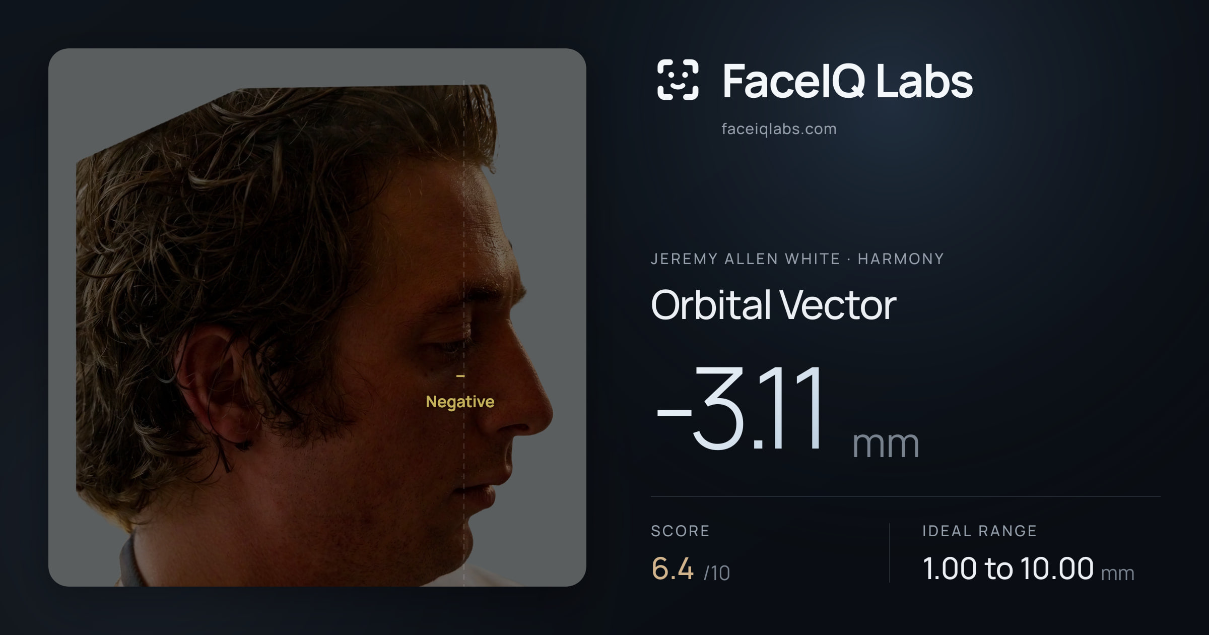 Jeremy Allen White Orbital Vector: -3.11mm, drawn on the photo