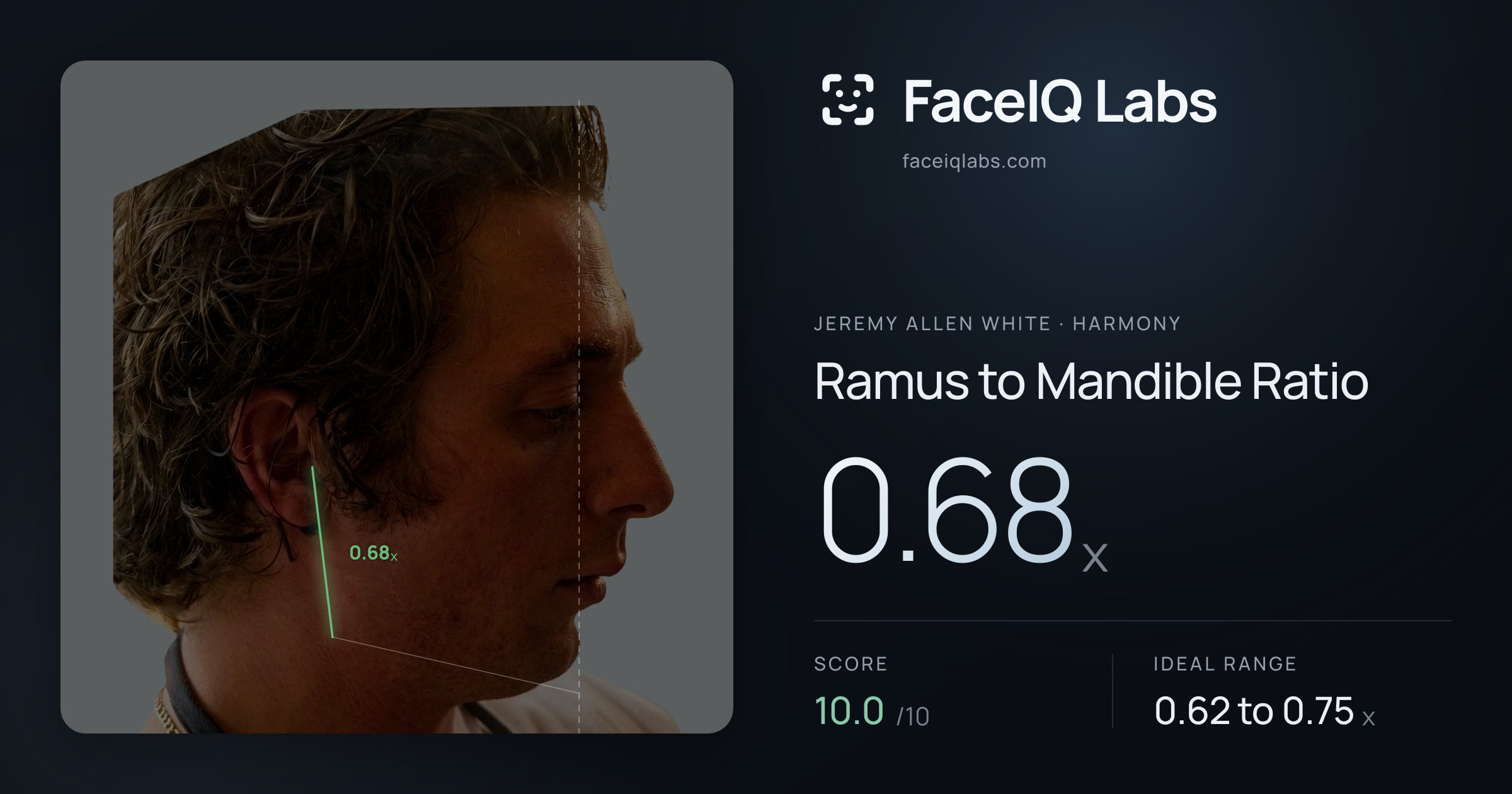 Jeremy Allen White Ramus to Mandible Ratio: 0.68x, drawn on the photo
