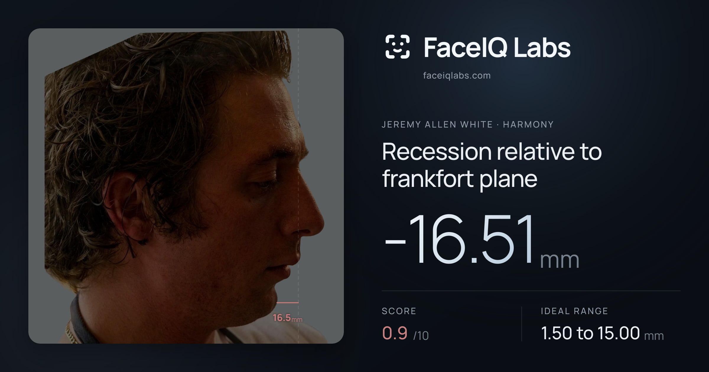 Jeremy Allen White Recession relative to frankfort plane: -16.51mm, drawn on the photo