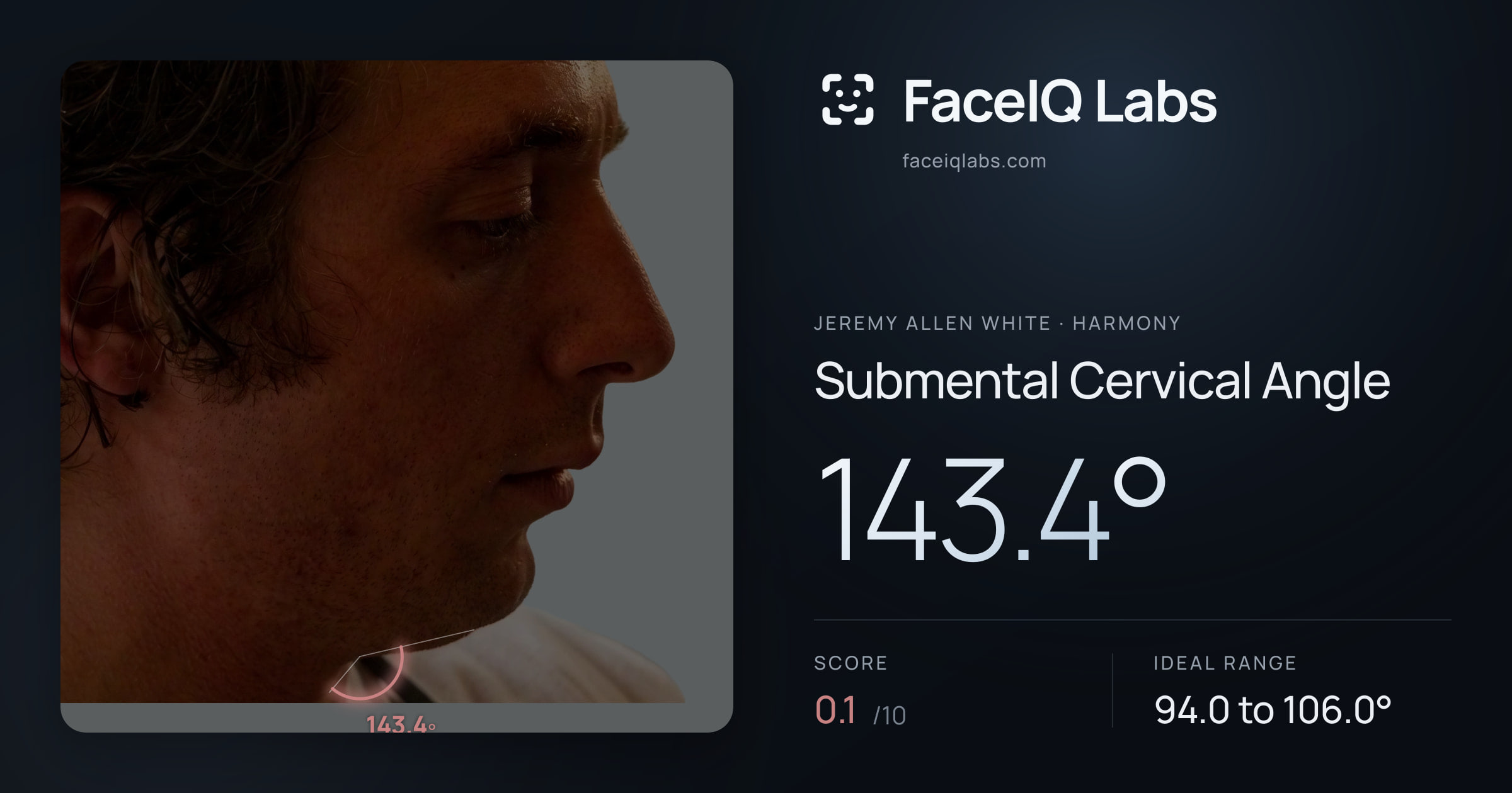 Jeremy Allen White Submental Cervical Angle: 143.4°, drawn on the photo