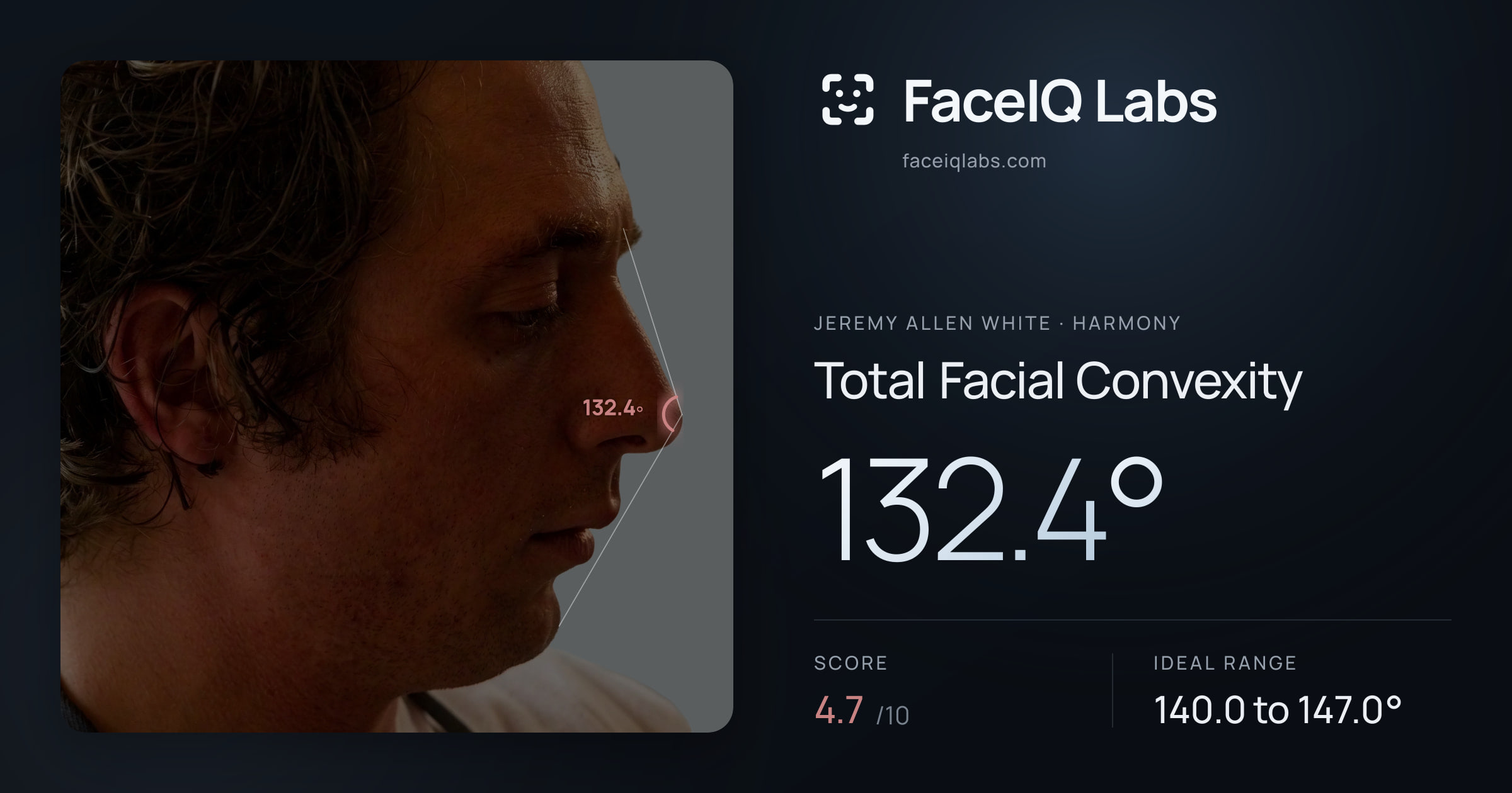 Jeremy Allen White Total Facial Convexity: 132.4°, drawn on the photo