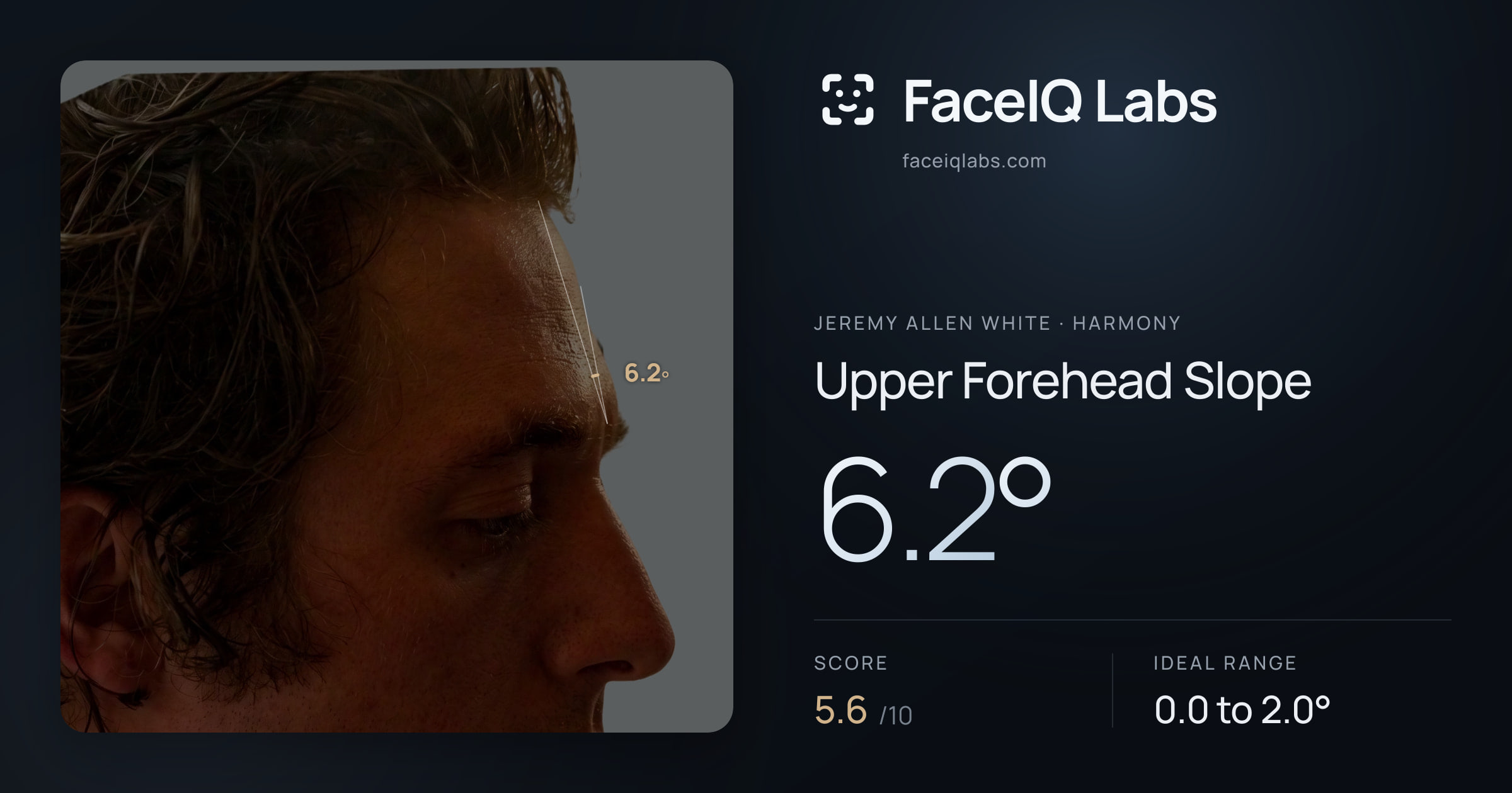 Jeremy Allen White Upper Forehead Slope: 6.2°, drawn on the photo