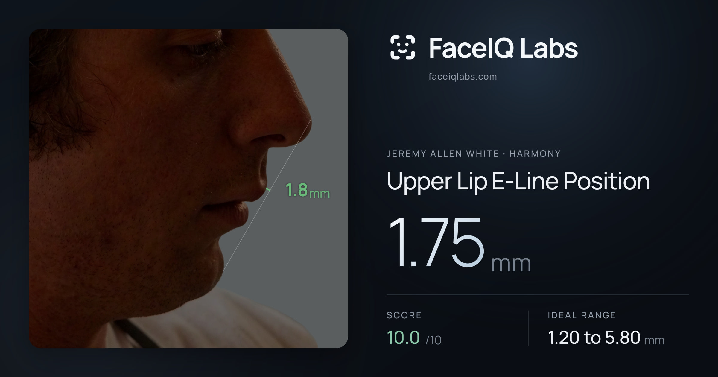 Jeremy Allen White Upper Lip E-Line Position: 1.75mm, drawn on the photo