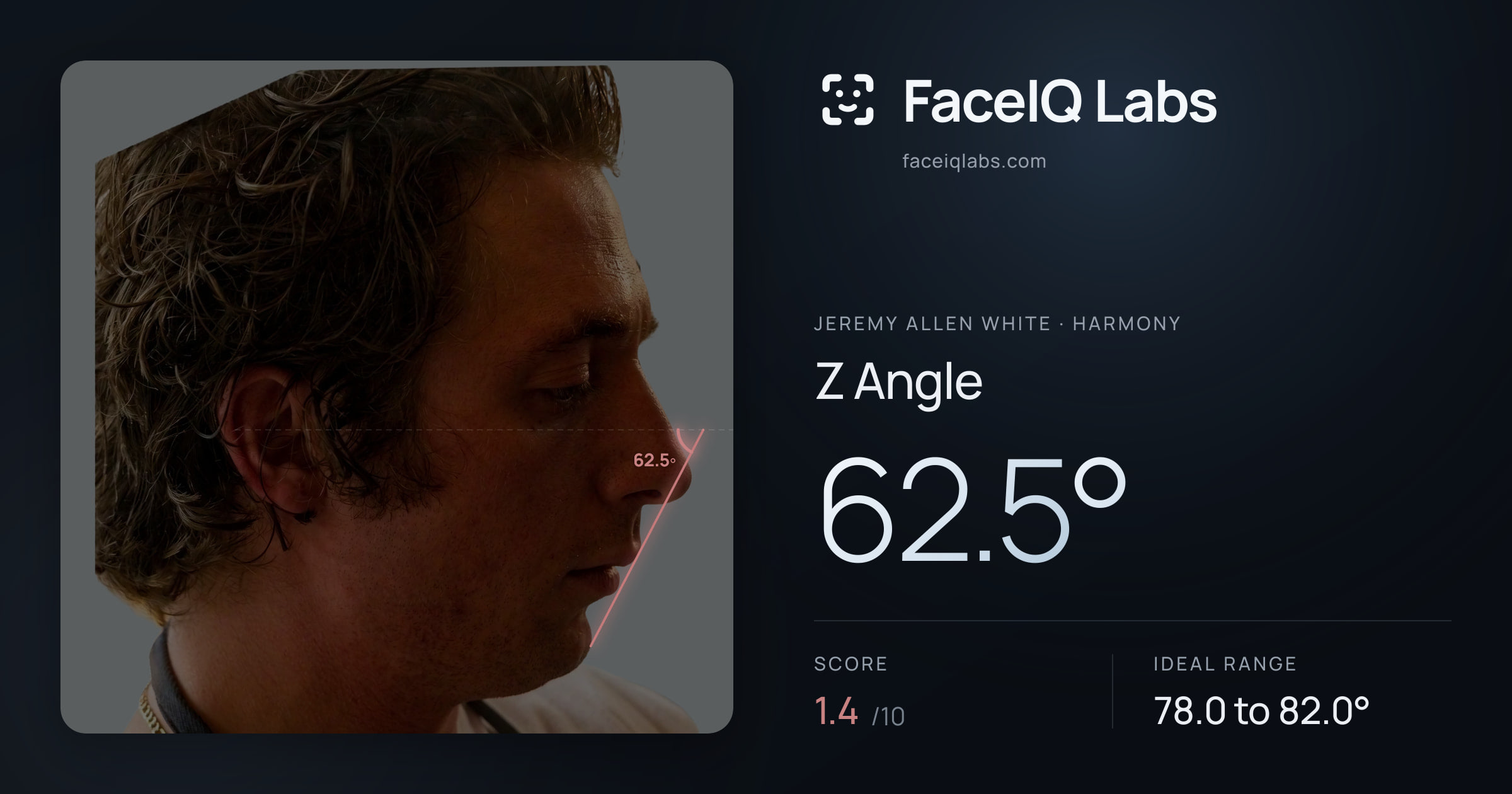 Jeremy Allen White Z Angle: 62.5°, drawn on the photo