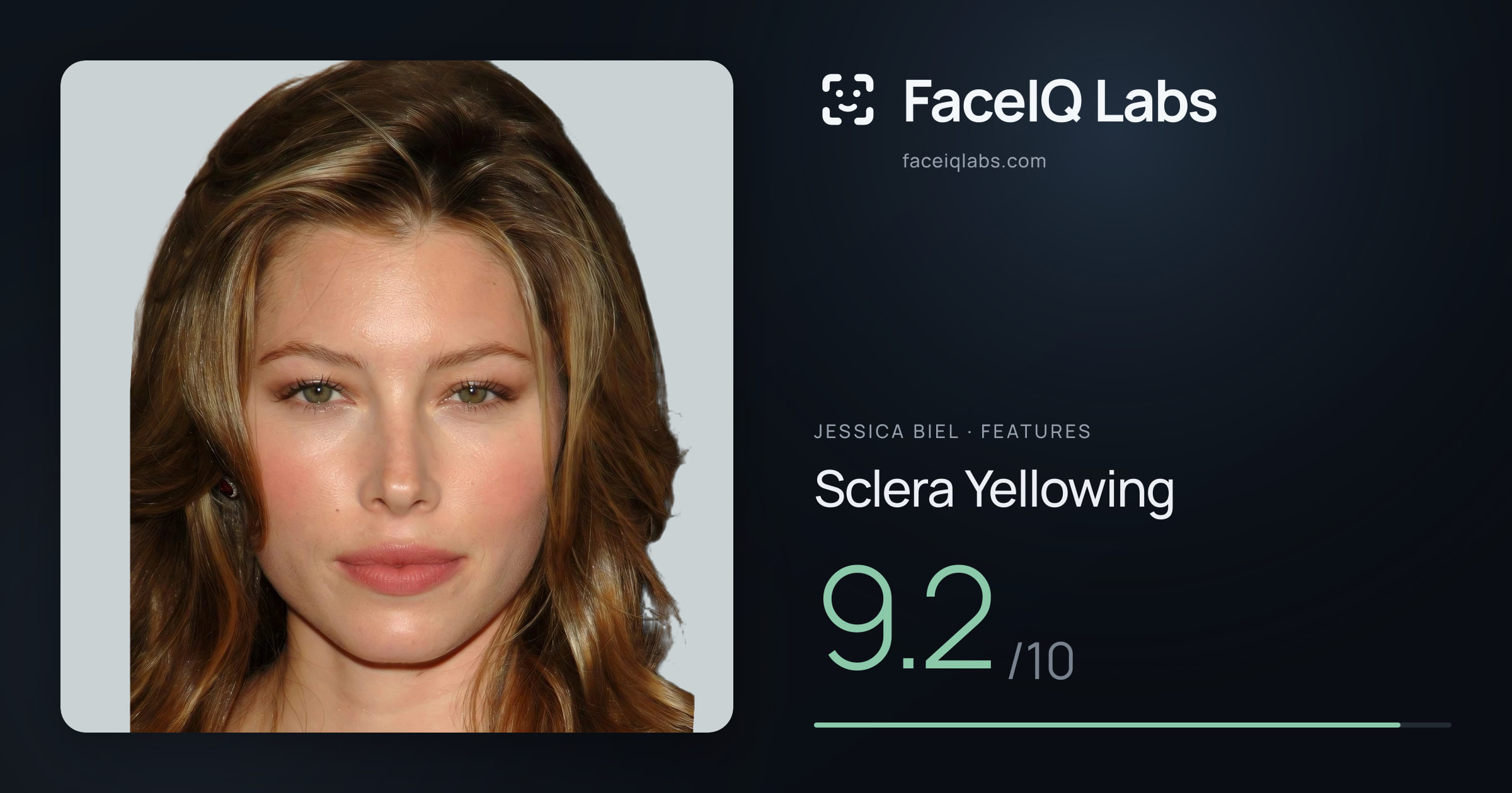 Jessica Biel Sclera Yellowing: 9.2/10, drawn on the photo