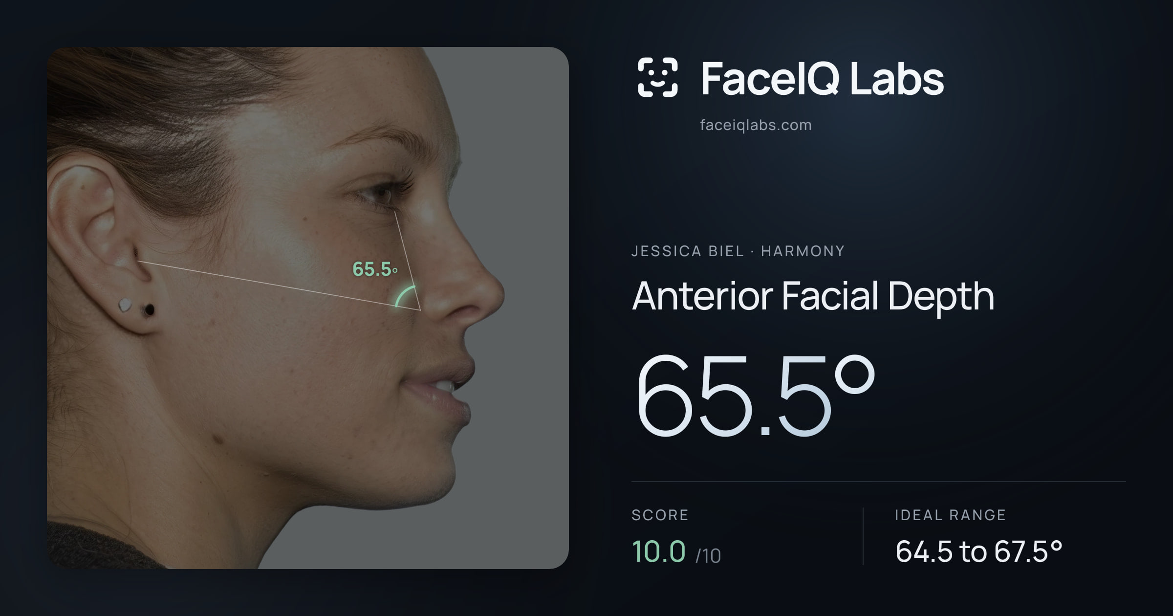 Jessica Biel Anterior Facial Depth: 65.5°, drawn on the photo
