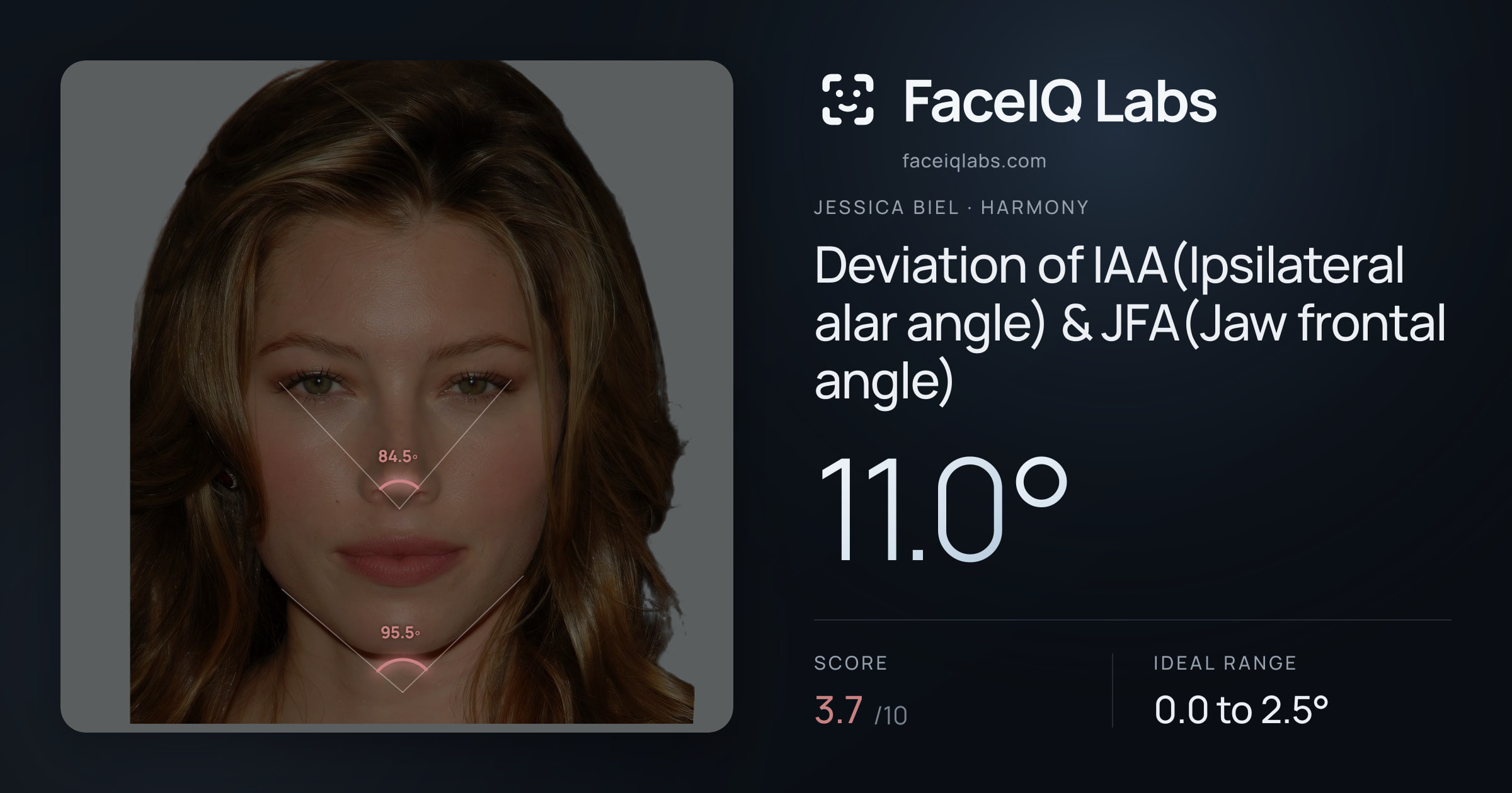 Jessica Biel Deviation of IAA(Ipsilateral alar angle) & JFA(Jaw frontal angle): 11.0°, drawn on the photo
