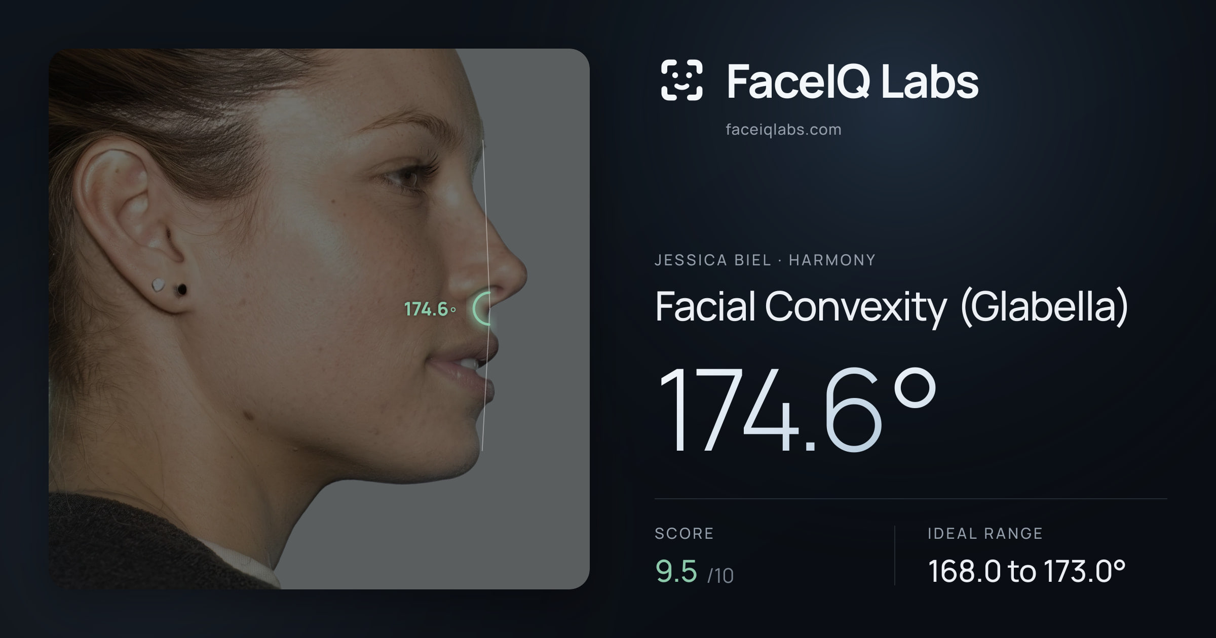 Jessica Biel Facial Convexity (Glabella): 174.6°, drawn on the photo
