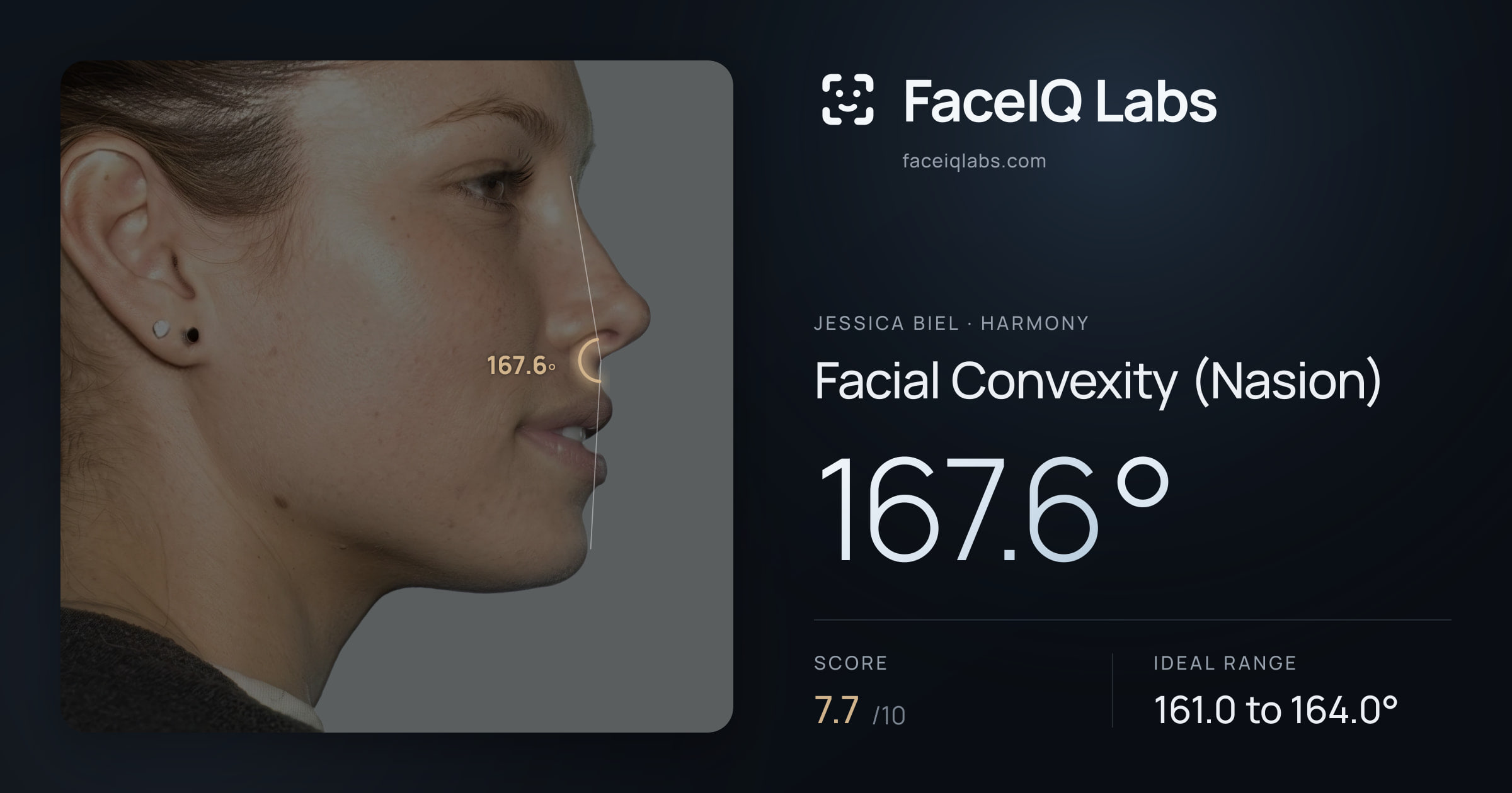 Jessica Biel Facial Convexity (Nasion): 167.6°, drawn on the photo