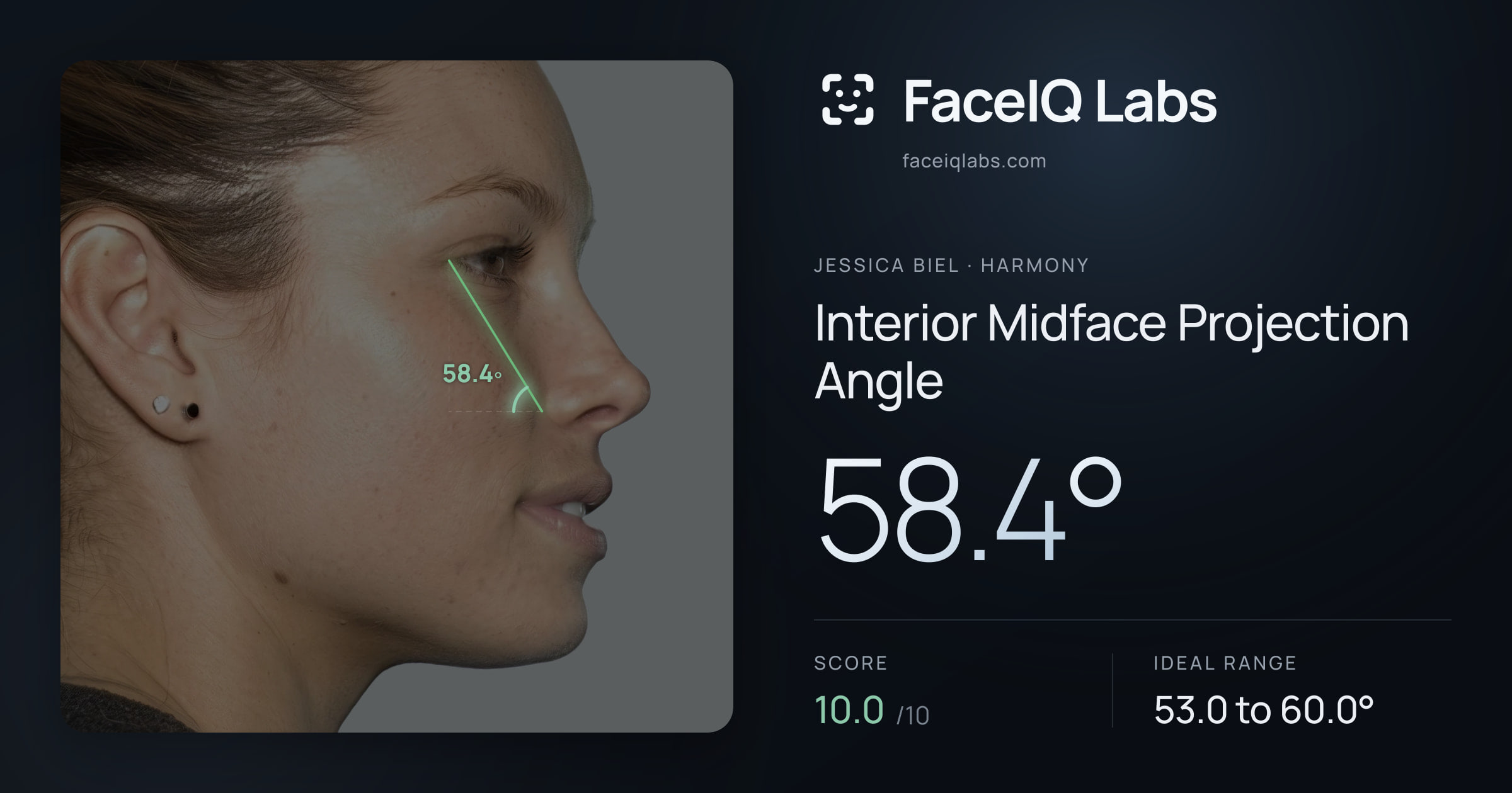 Jessica Biel Interior Midface Projection Angle: 58.4°, drawn on the photo