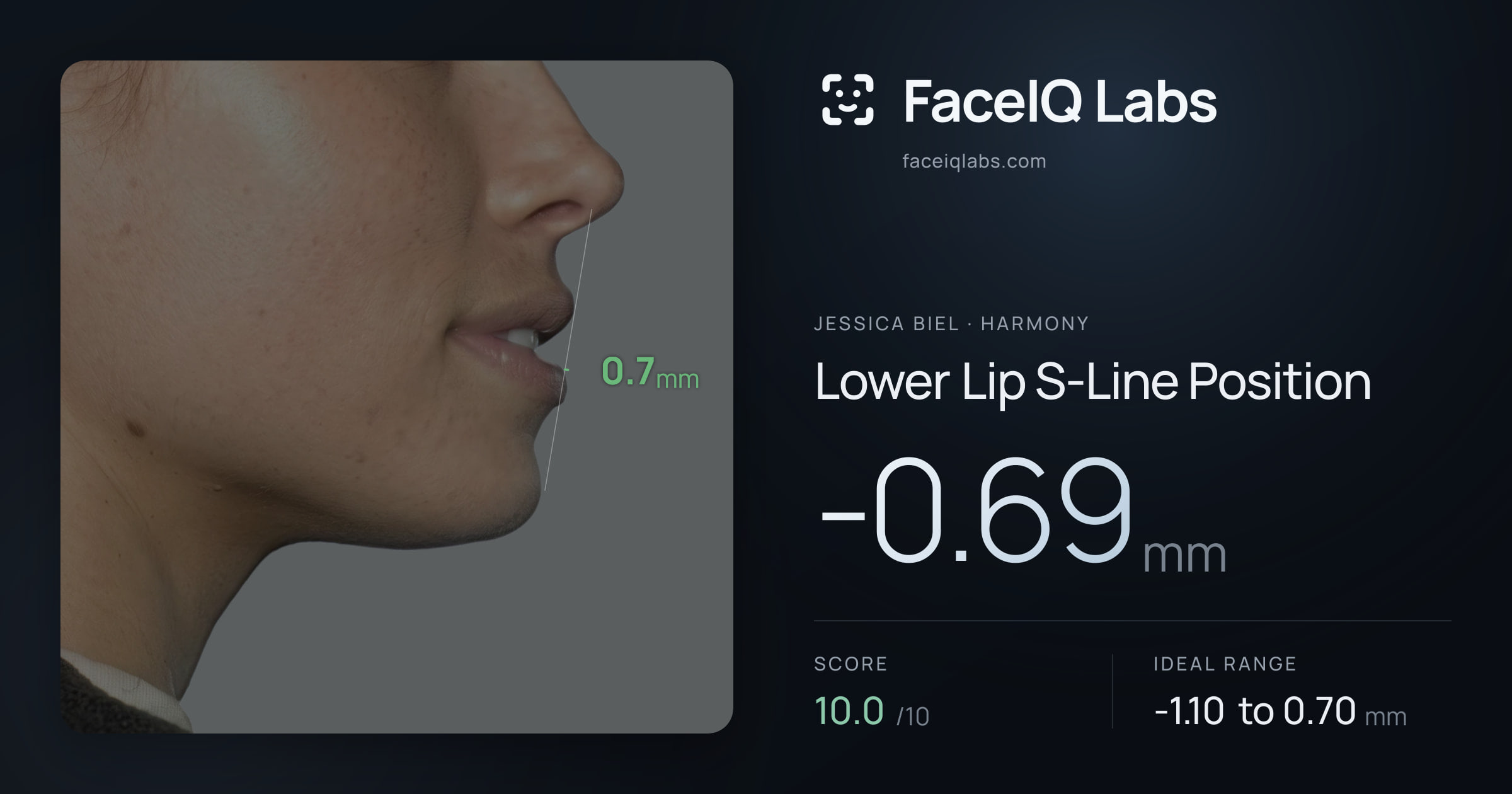 Jessica Biel Lower Lip S-Line Position: -0.69mm, drawn on the photo