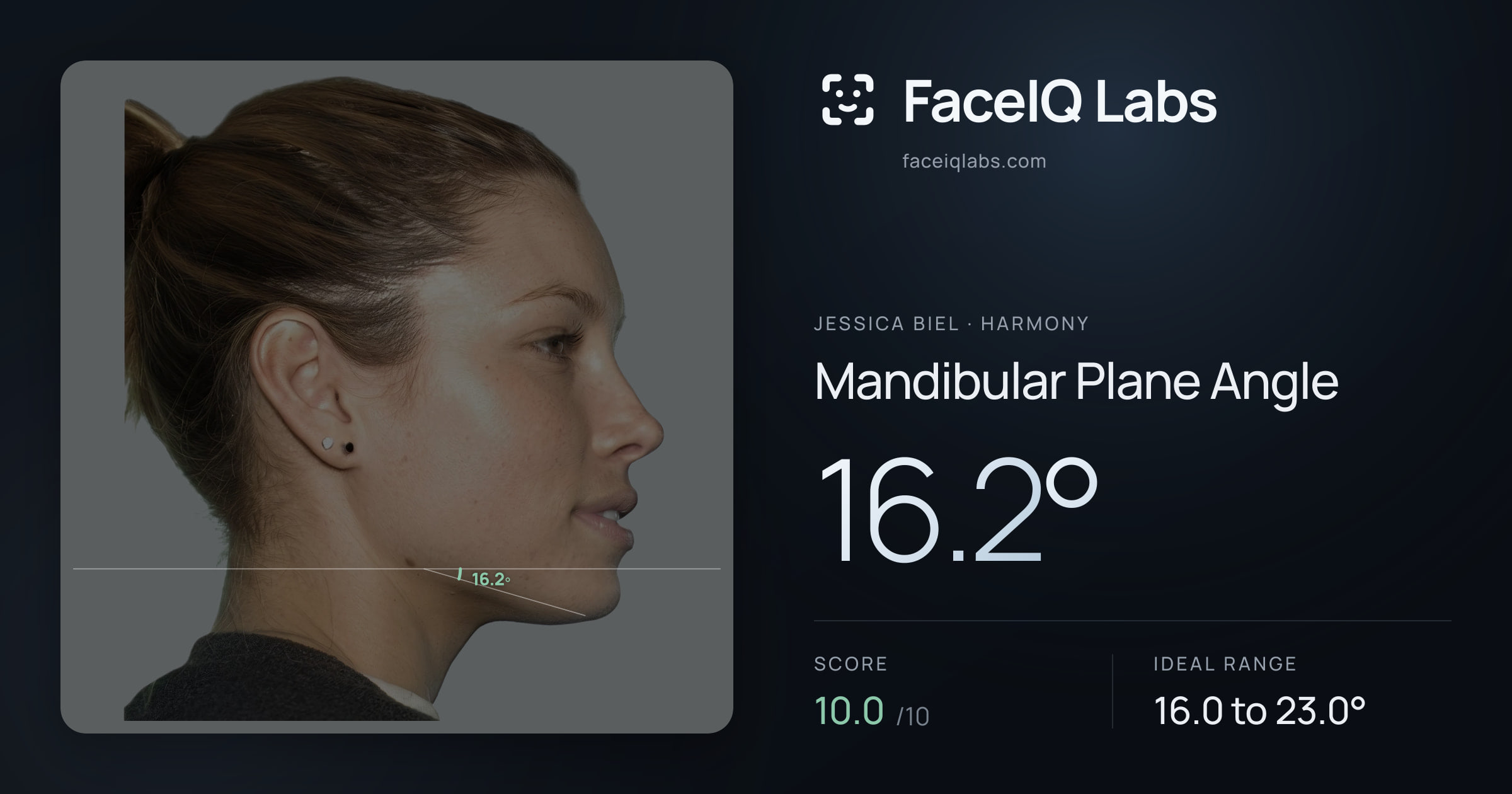 Jessica Biel Mandibular Plane Angle: 16.2°, drawn on the photo